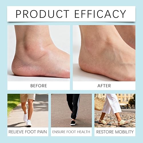 Miniatura 4 de Crema para el cuidado de pies para pies secos y ásperos, bálsamo hidratante intenso y reparador con fórmula ligera de absorción rápida para