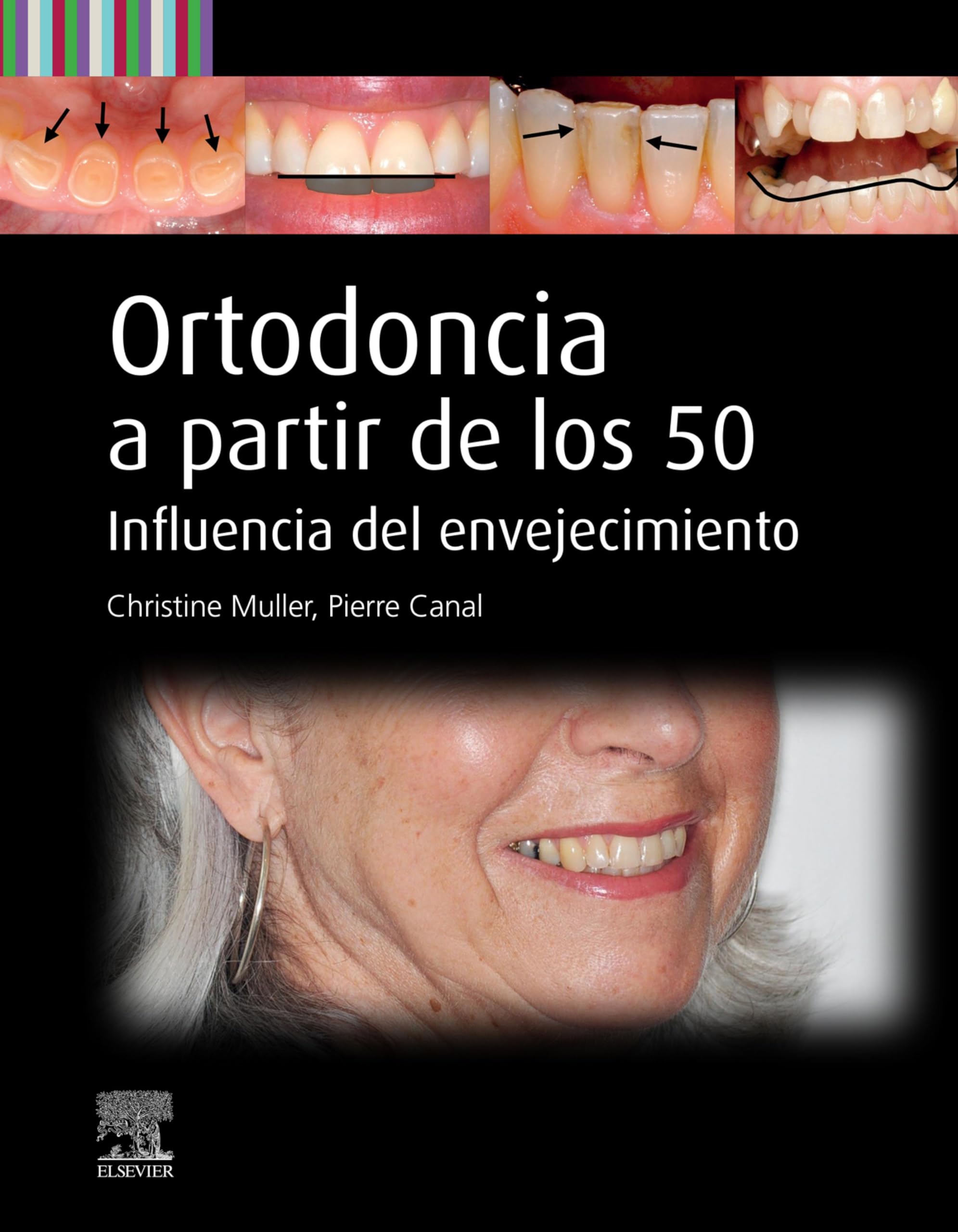 Ortodoncia a partir de los 50: Influencia del envejecimiento