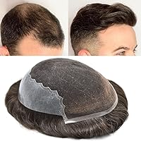 Vista 14 de Peluca tipo tupé para hombre, sistema de reemplazo de cabello humano europeo indetectable, encaje francés, nudos blanqueados, línea capilar natural