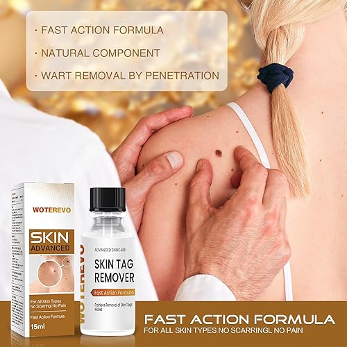 Miniatura 2 de Removedor de verrugas para hombres y mujeres, cuello, axilas, ingle, amarillo 1