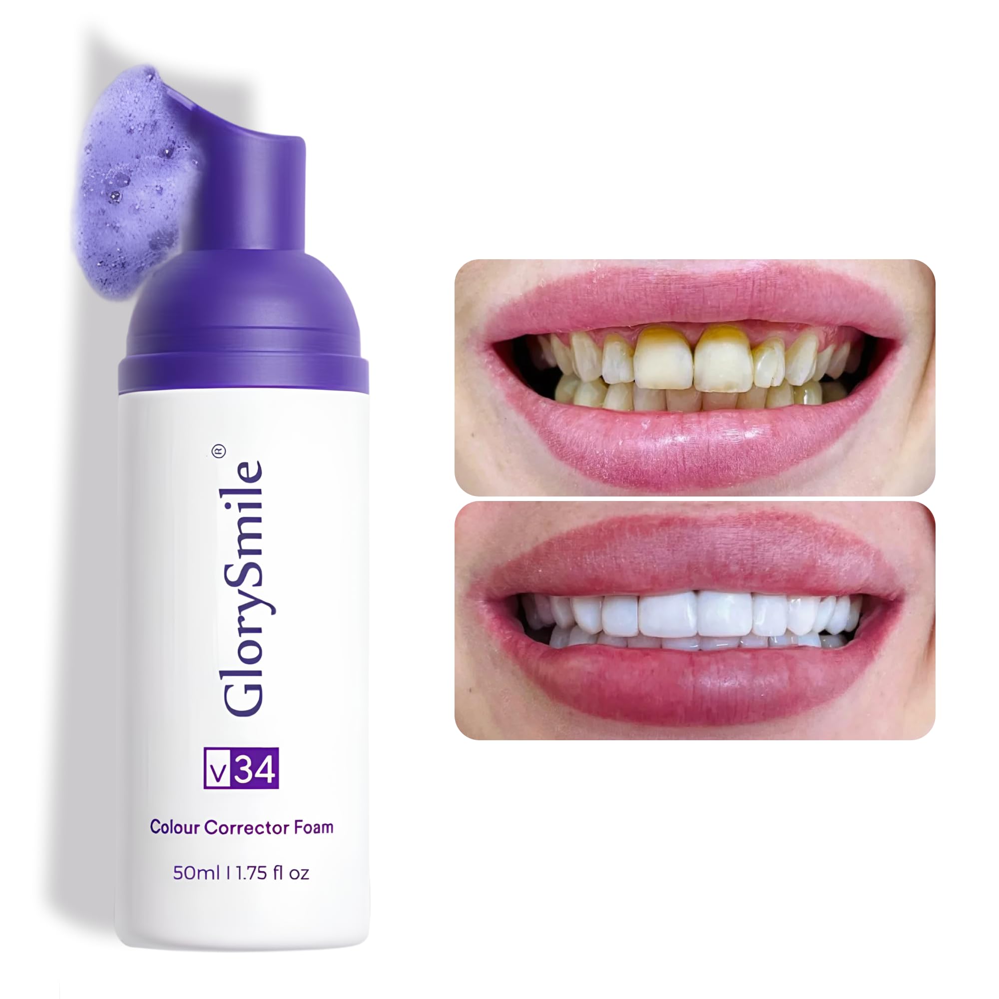 Purple Color-Correcting Teeth Whitening Foam, 50ml, Advanced Gentle Brightening and Stain-Removing Formula for Daily Use, Fresh Minty Flavor, Ideal for Sensitive Smiles
