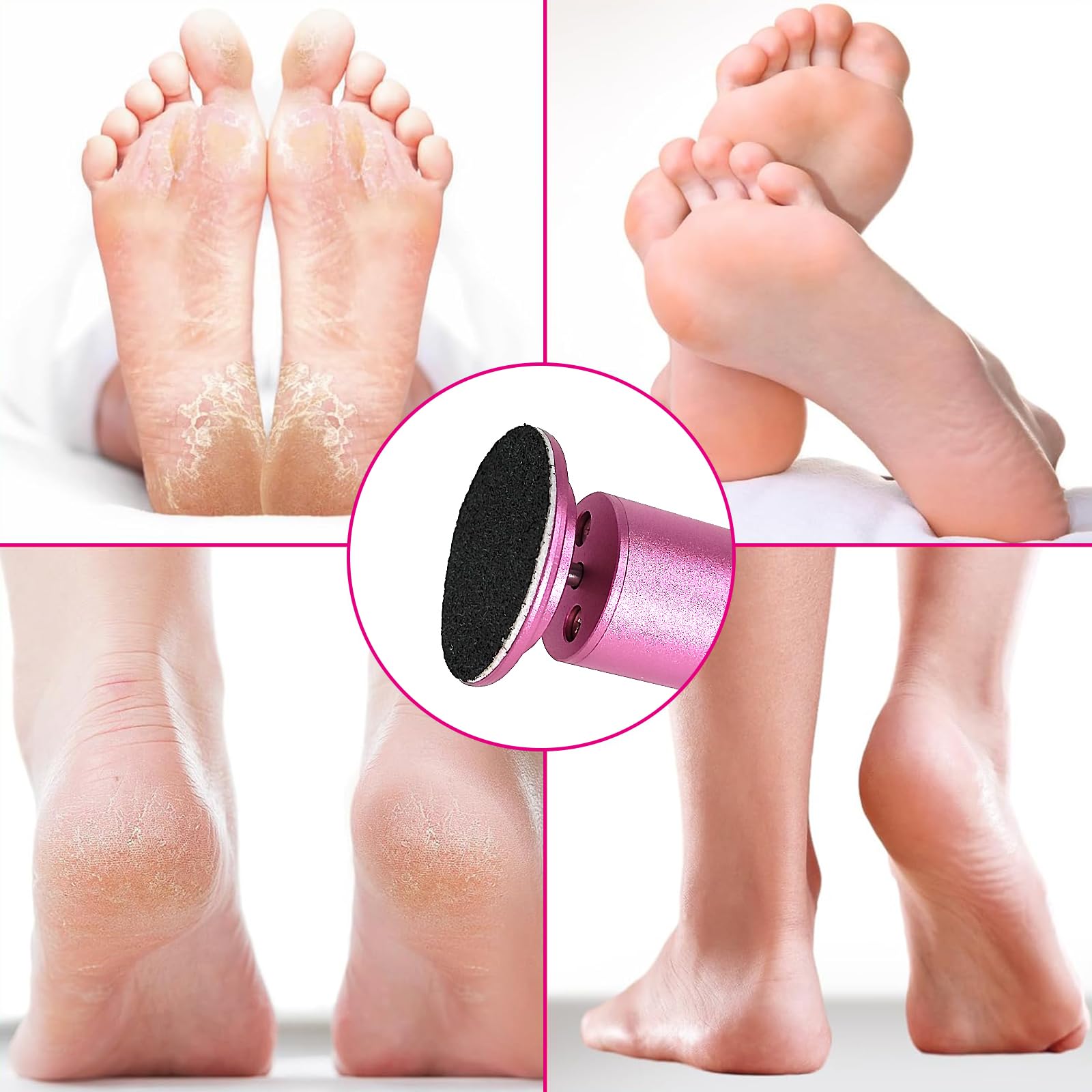 Removedor eléctrico de callos de pies, herramienta profesional de pedicura con 60 papeles de lijado, color rosa