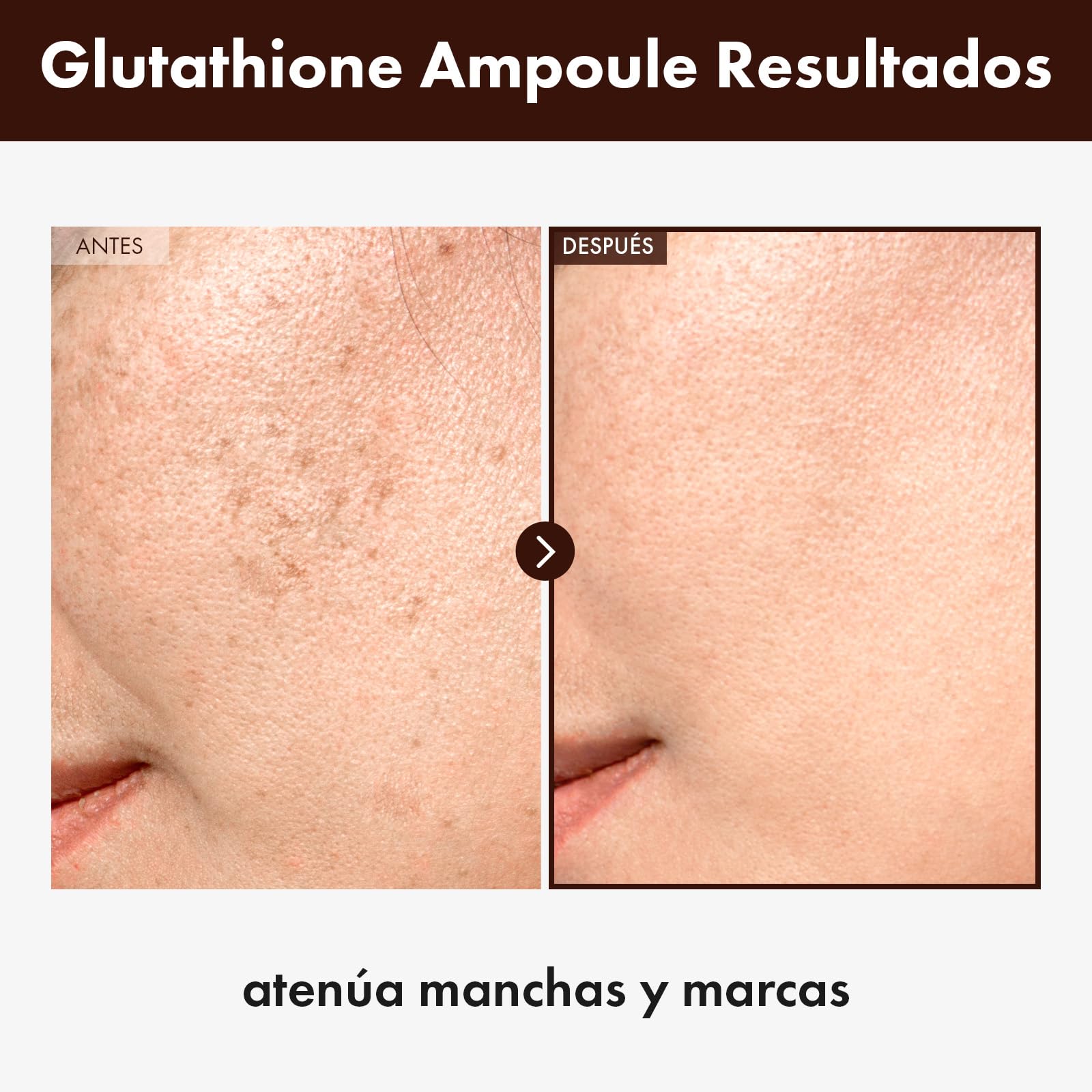glutathione resultados de 4 Semanas con Esther Formula no contiene soja Are Glutathione Supplements a Scam?