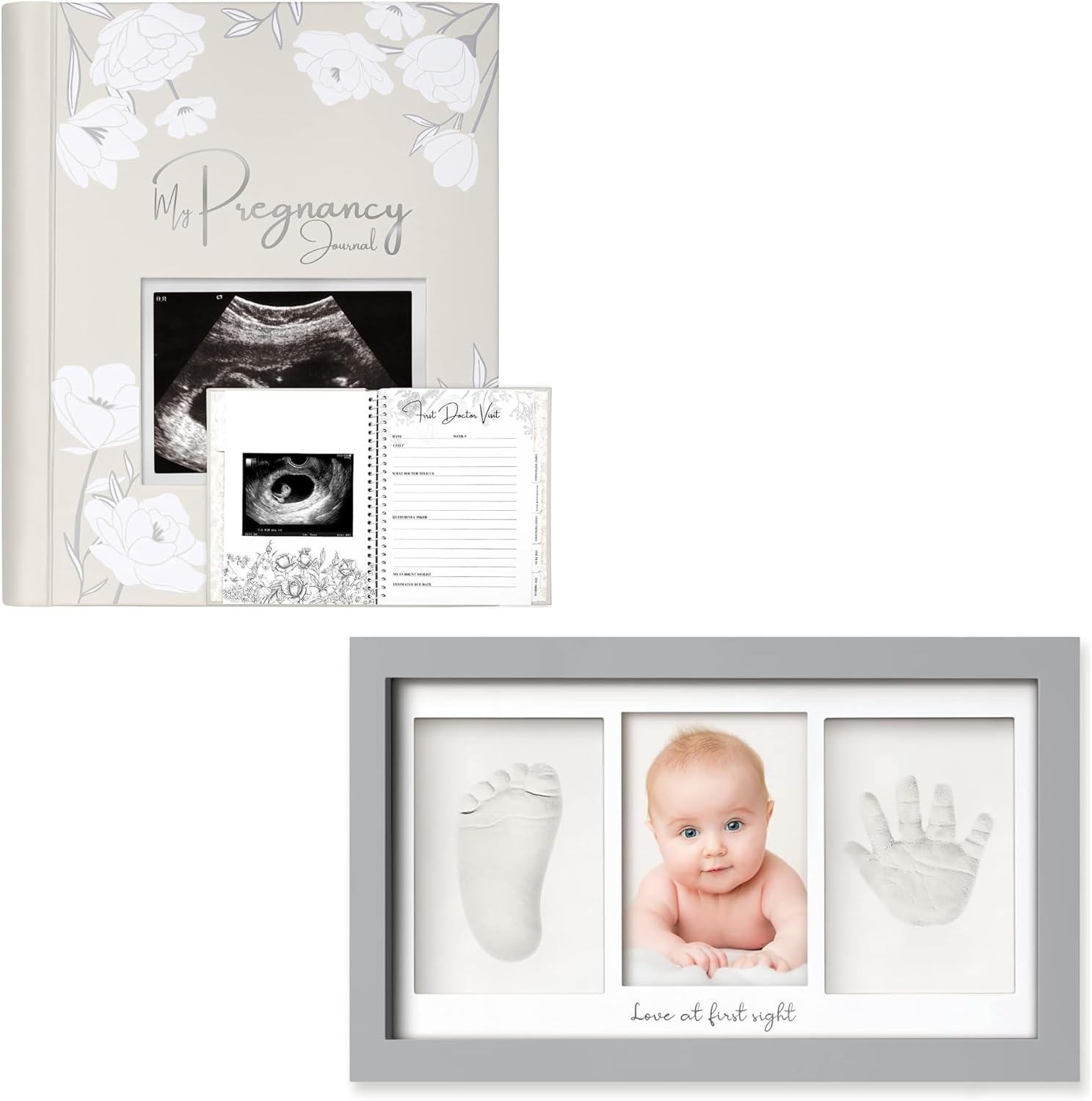 KeaBabies Pregnancy Journal, Pregnancy Announcements & Baby Hand and Footprint Kit - 80 Pages Hard Cover Pregnancy Book For Mom To Be Gift - Baby Footprint Kit, Newborn Keepsake Frame