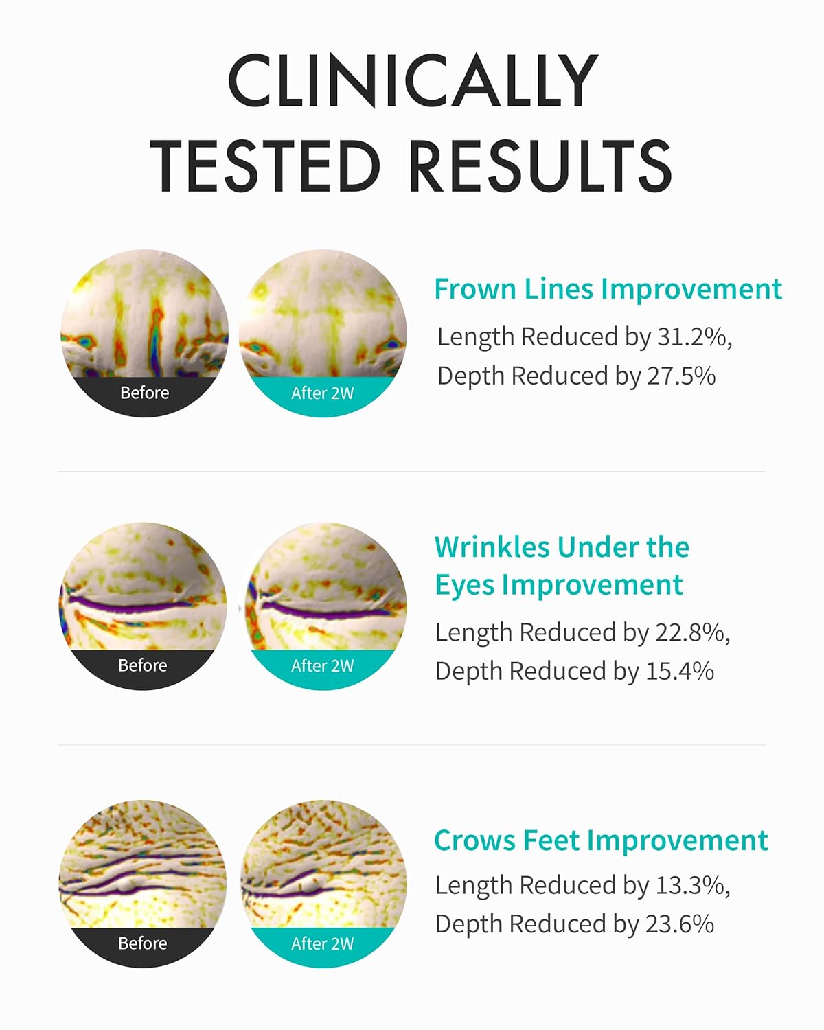 REJURAN® Intensive Eye Cream, c-PDRN® - Fast-Acting Eye Treatment for Wrinkles, Lifting, and Dark Circles. Instant Hydration and Visible Revitalization. Korean Skin Care (0.67 fl oz) - Image 3