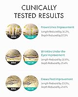 Vista 3 de REJURAN Crema intensiva para ojos, c-PDRN - Tratamiento ocular de acción rápida para arrugas, levantamiento y ojeras. Hidratación instantánea