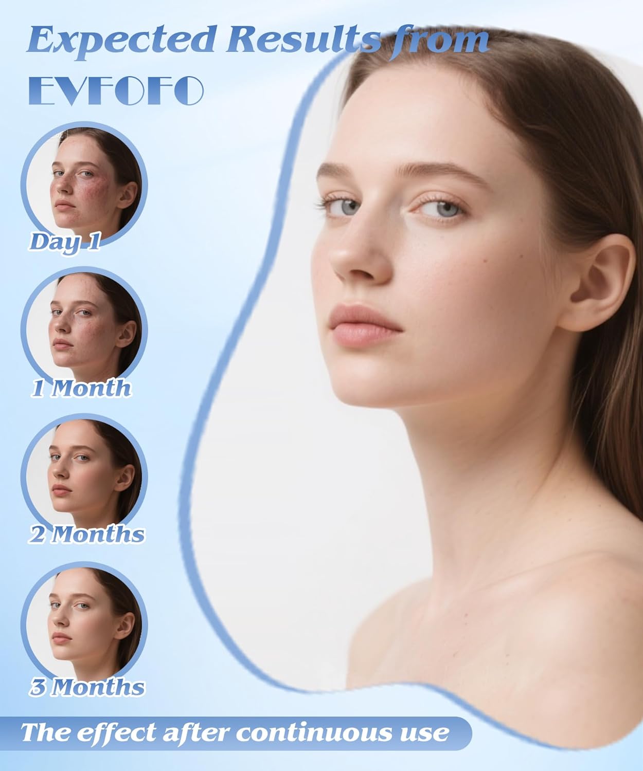 Red Light Therapy for Face, Light Therapy Mask for Firming, Wrinkles & Acne, Wireless Red & 850nm Infrared Light Silicone Mask, 7-Color LED Face Mask Portable for Use at Home & Travel, Green - Image 4