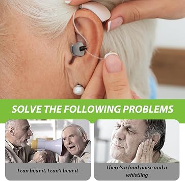 10 Pack Hearing Aid Domes for Phonak, Sound Amplifier Ear Pieces Double Layer Open Domes Washable Anti Static Silicone Earbud Tips Replacement Hearing Aid Accessories for Seniors (S, 9mm)