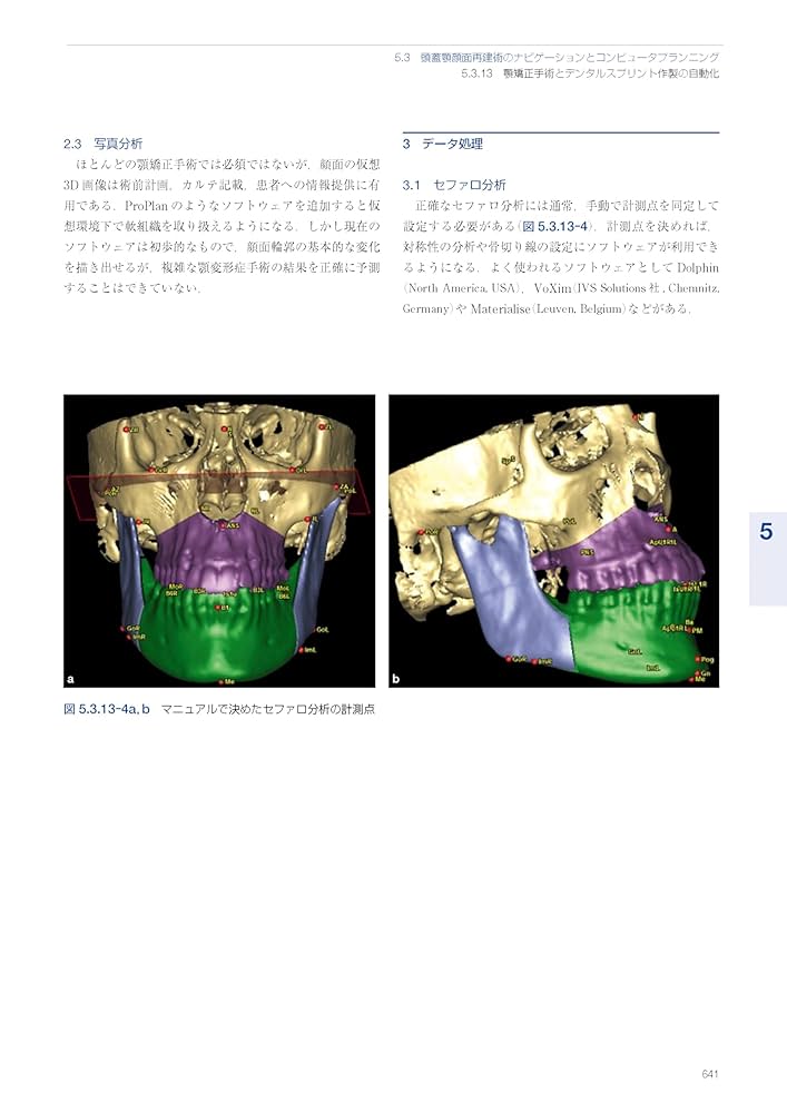 AO法骨折治療 アドバンスト頭蓋顎顔面手術: 腫瘍、骨矯正、外傷