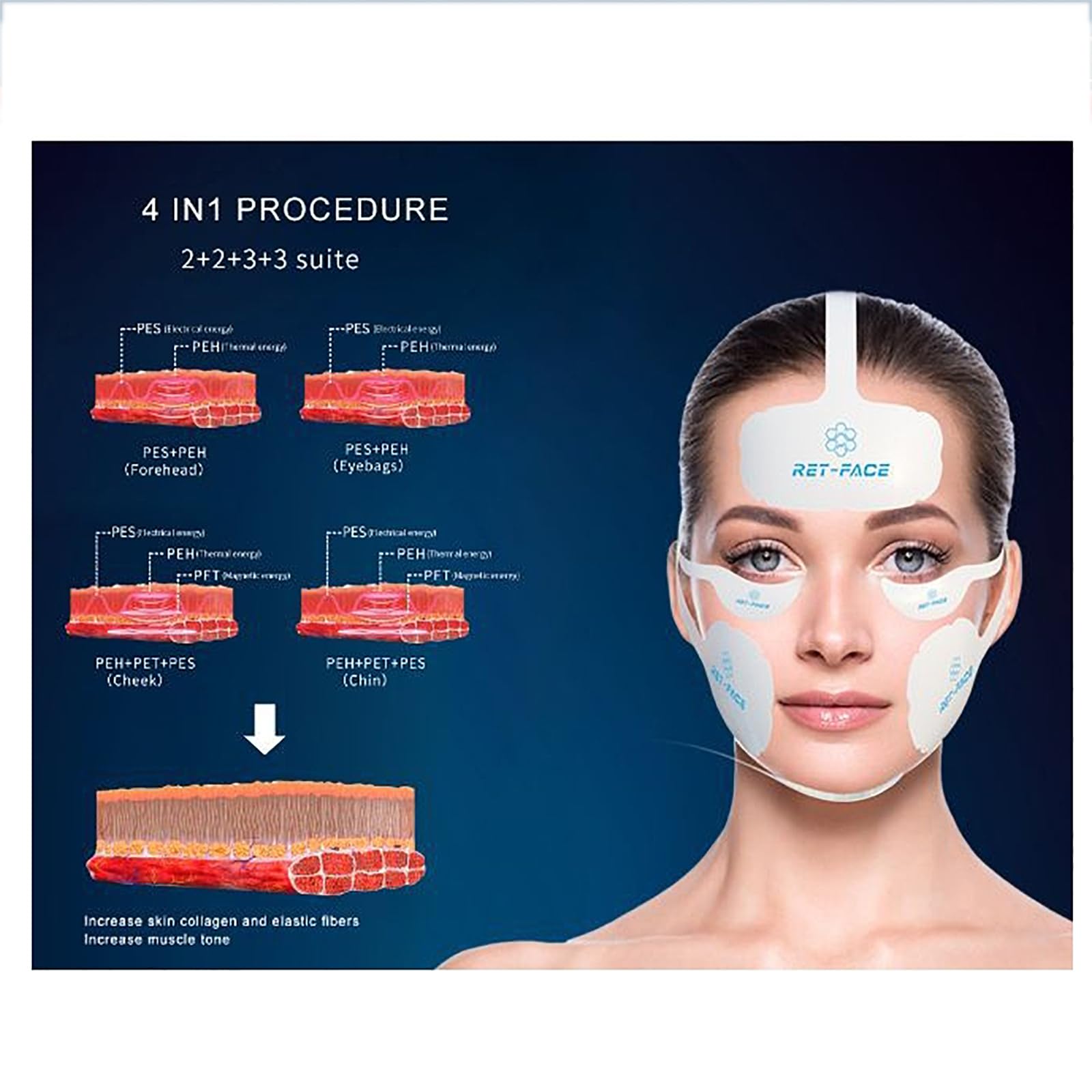 Machine Lifting Magnétique,machine Beauté Pour Soins Peau 7D Avec 1 Poignée Et 3 Sondes Profondeur, Énergie Réglable 1-10J Et Fréquence 1-8Hz,absorption Complète À 100%, Effet Visible 15 Minutes