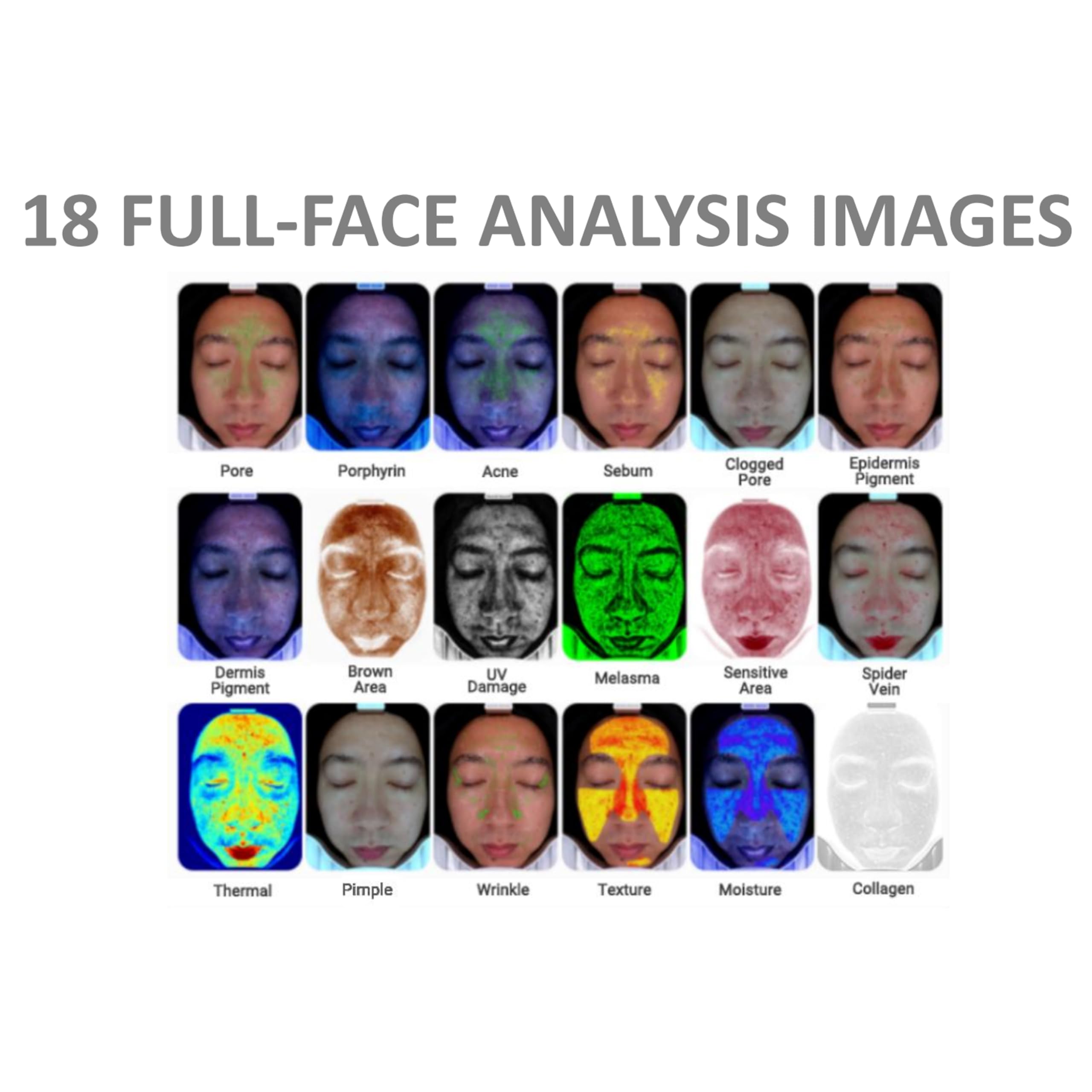 Elitzia Rilevatore di analizzatore della pelle 15,6 pollici HD AI Smart Facial Skin Analisi Macchina 10 Spettro 20 Megapixel