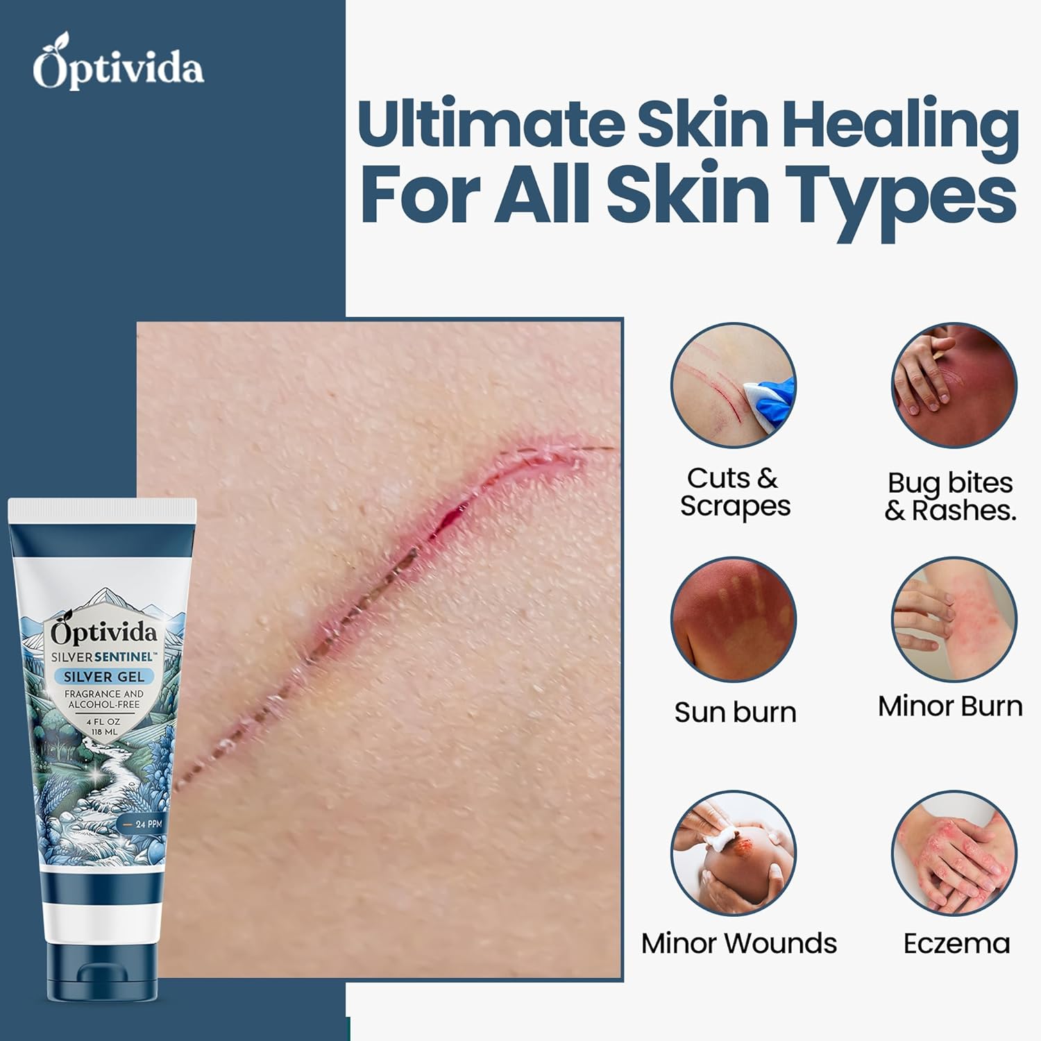 OPTIVIDA Colloidal Silver Gel for Wound Care, Natural Topical Skin Healing | Nano-Silver Topical Gel for Wounds, Burns, Rashes, Skin Irritations, Unscented