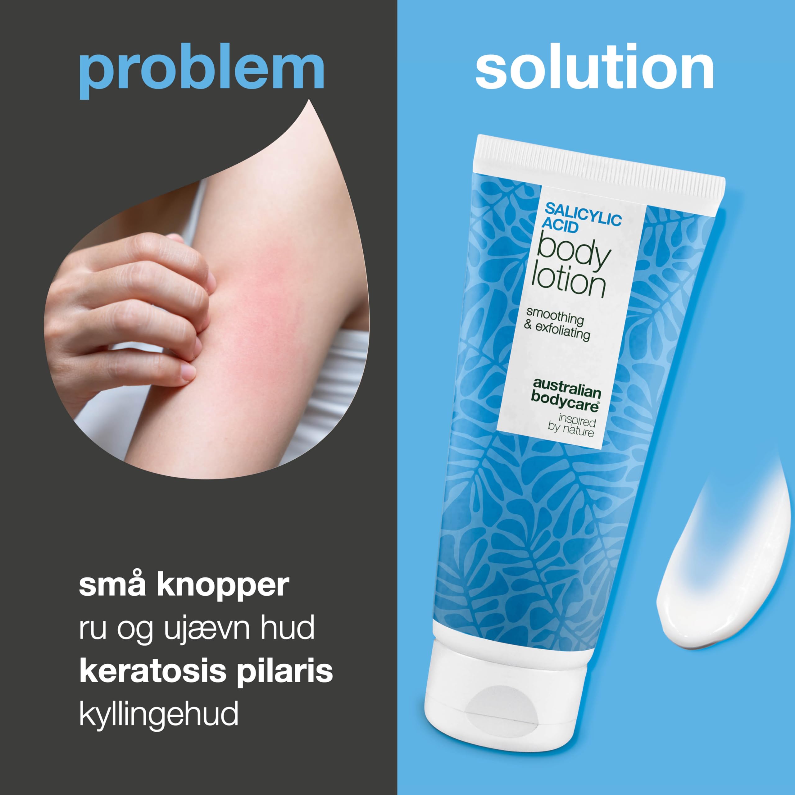 Balsam do ciała na Keratosis Pilaris – wygładza gęsią skórkę i drobne krostki – z kwasem salicylowym, niacynamidem i cynkiem PCA