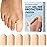 Dr. Frederick\'s Original Soft Gel Toe Protectors for Men & Women - 6 ct - Toe Caps for Foot Pain Relief - Sleeves for Ingrown Toenails, Corns, Calluses, and Blisters - Large - Beige