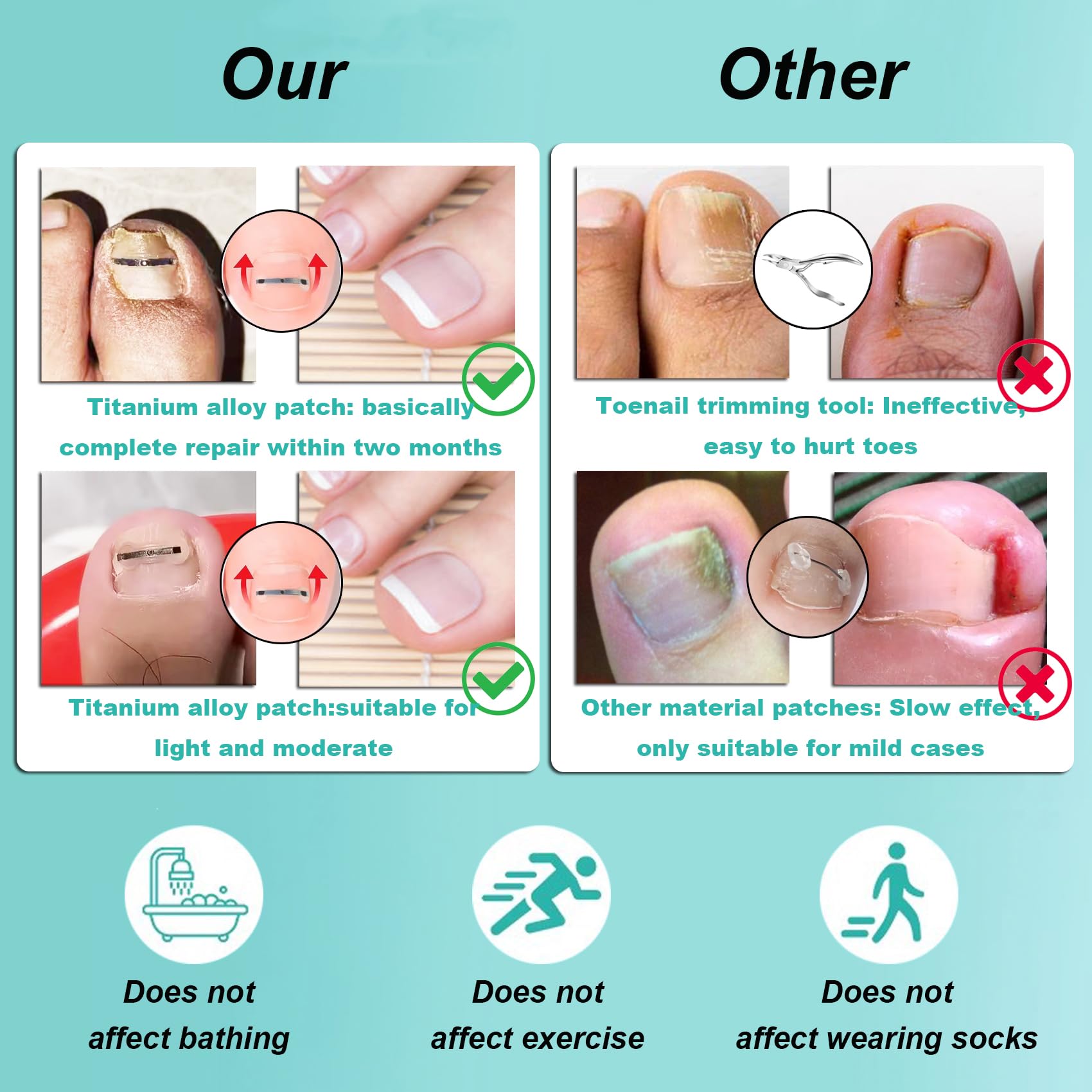 Ensemble Professionnel Pour la Correction des Ongles Incarnés : Patchs de Correction des Ongles et Outils Efficaces Pour Ongle Incarné