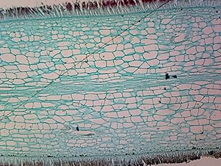 Phaeopphyta Brown Algae, Laminaria - Microscope Slide