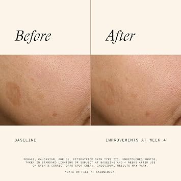 Even & Correct Dark Spot Cream - For Reducing the Most Stubborn Dark Spots