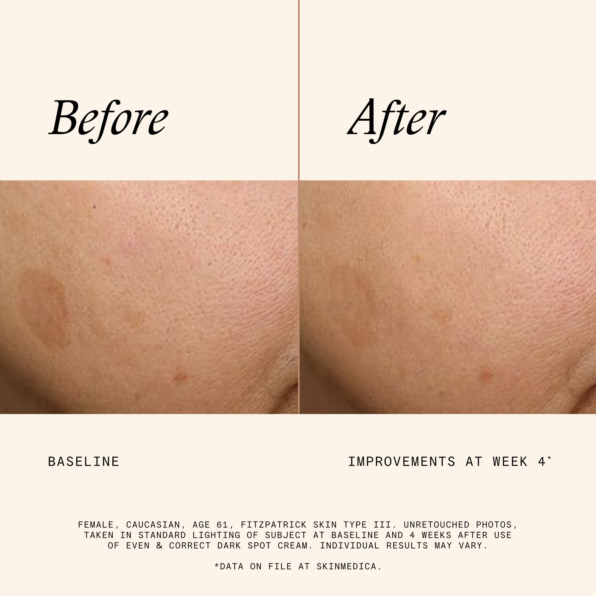 Even & Correct Dark Spot Cream - For Reducing the Most Stubborn Dark Spots