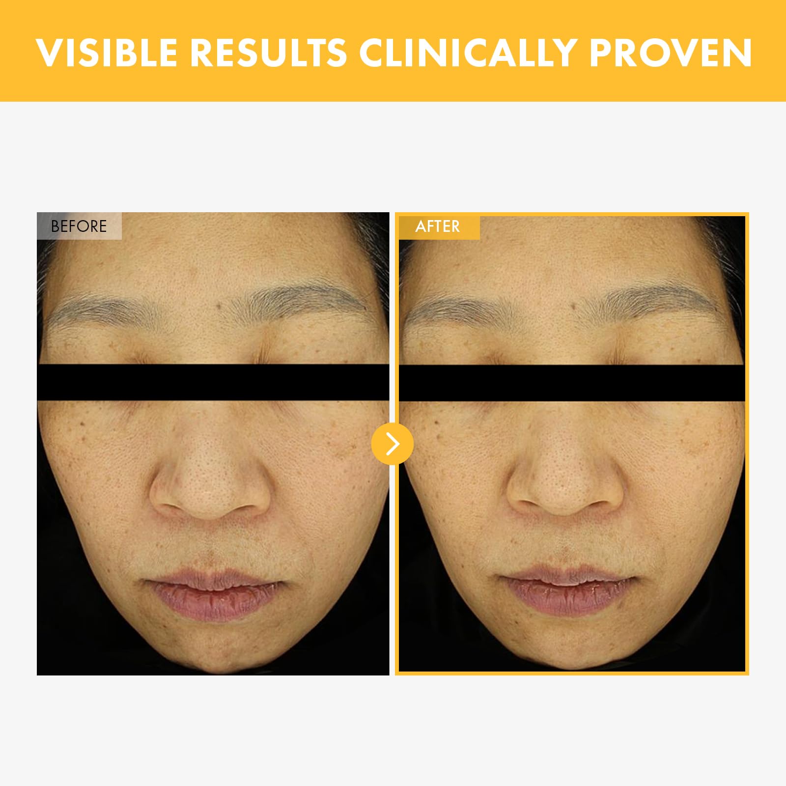 TOSOWOONG 8 Days Spot Cream, Dark Spot Remover for Face Age Spot, Sun Spot, Freckles, Melasma, Brown Spot Serum - Image 2
