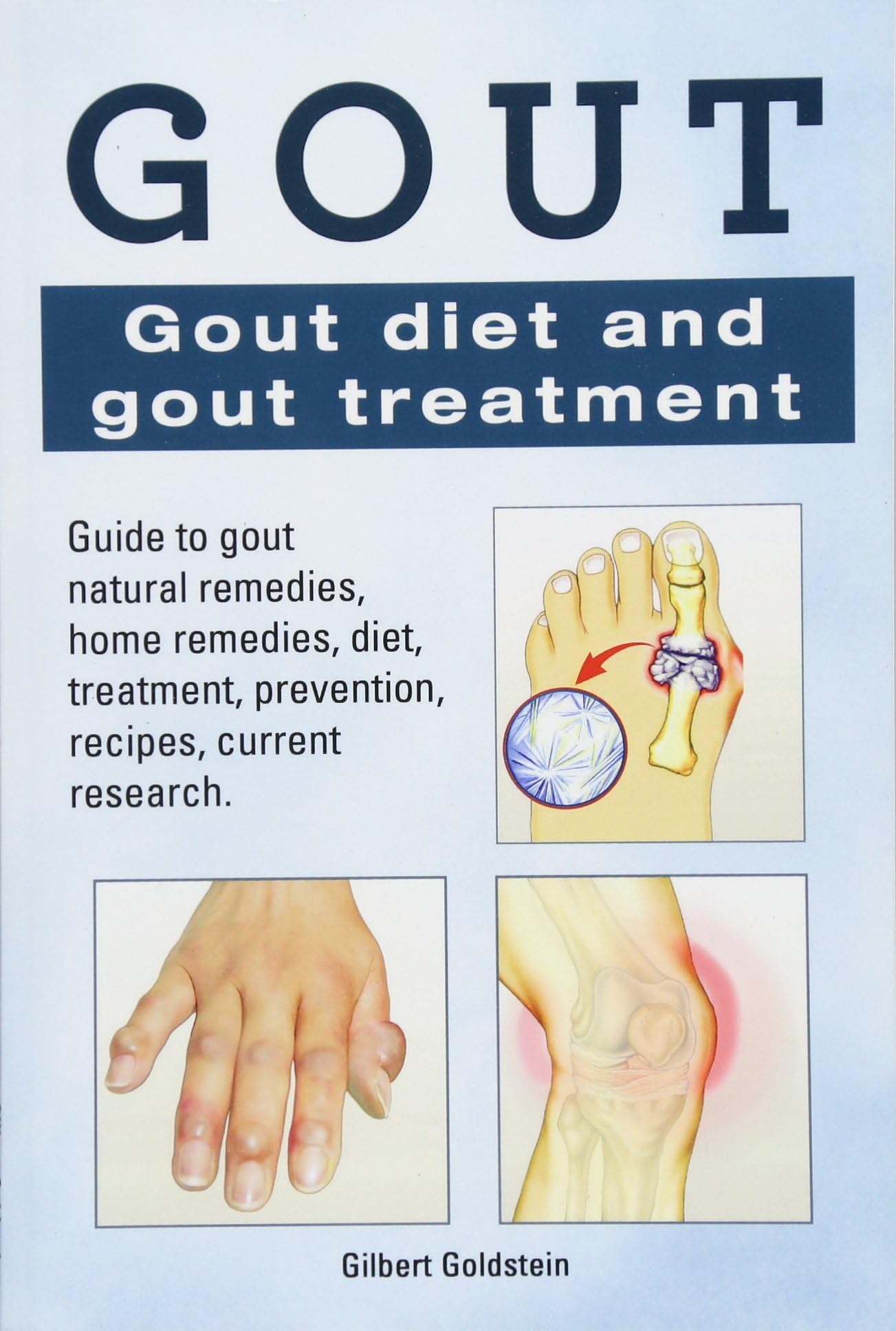 Gout. Gout diet and gout treatment. Guide to gout natural remedies, home remedies, diet, treatment, prevention, recipes, current research. Paperback – 29 Jan. 2015