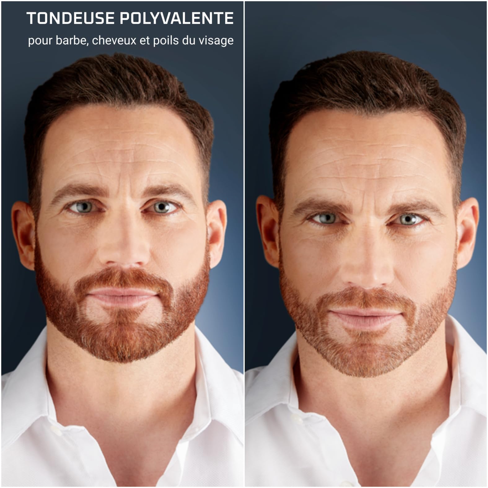 Rowenta Selectium Tondeuse multi-usage 12-en-1, Lames titane, Barbe cheveux et visage, Étanche, Autonomie 120 min, Charge rapide, Indicateur de batterie numérique, Housse de transport TN9461F4