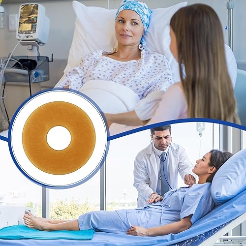 Miniatura 7 de Los anillos de barrera para ostomía se adaptan al extensor de piel moldeable, diámetro exterior de 2 pulgadas (1.890 in) a 0.079 in de grosor, bolsa