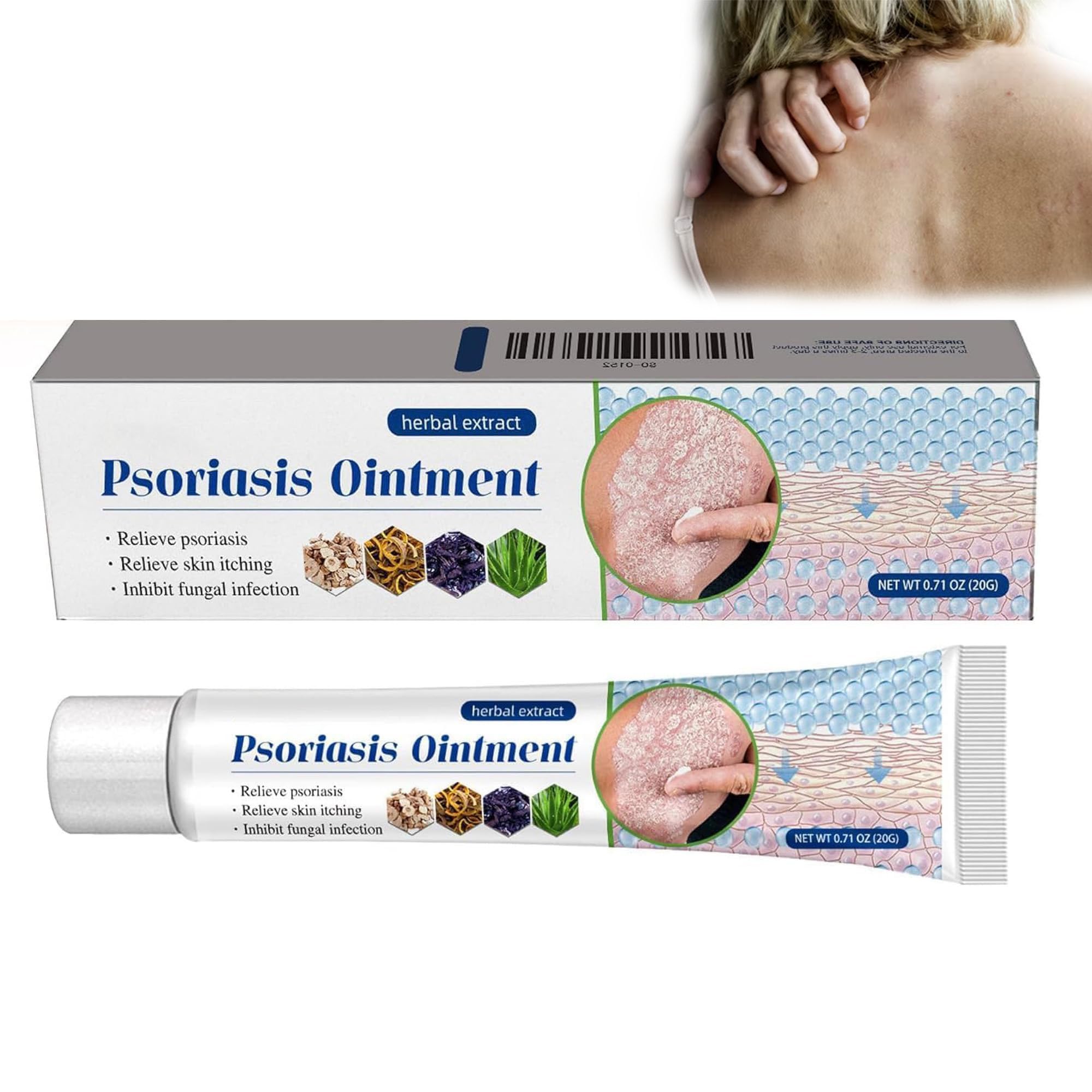 Antifungal Cream 20g - Psoriasis Cream,Anti Itch Cream Treats Jock Itch, Ringworm, Eczema, Dermatitis,Athlete's Foot, Relieves Itching.Moisturising Cream Soothes Fungal Skin So Soft on Body and face