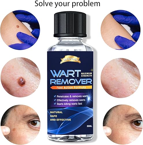 Miniatura 5 de Removedor de marcas cutáneas, removedor de verrugas, congelación removedor de verrugas de ácido salicílico para hombres y mujeres, eliminación de