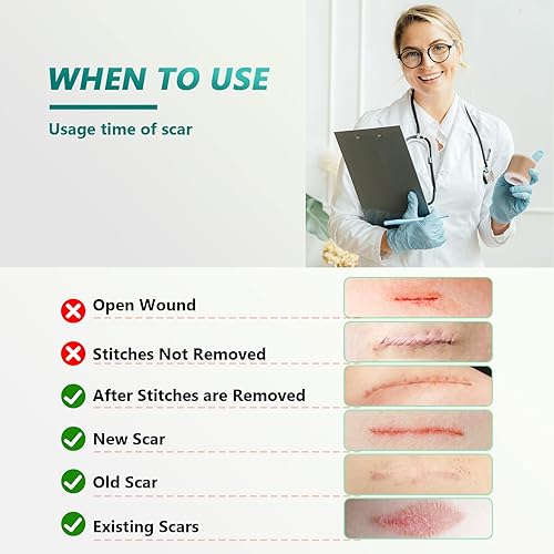 Miniatura 7 de Cinta de silicona para cicatrices quirúrgicas (rollo de 1.6 x 80 pulgadas, 6.6 ft), láminas de silicona de grado médico para cesáreas,