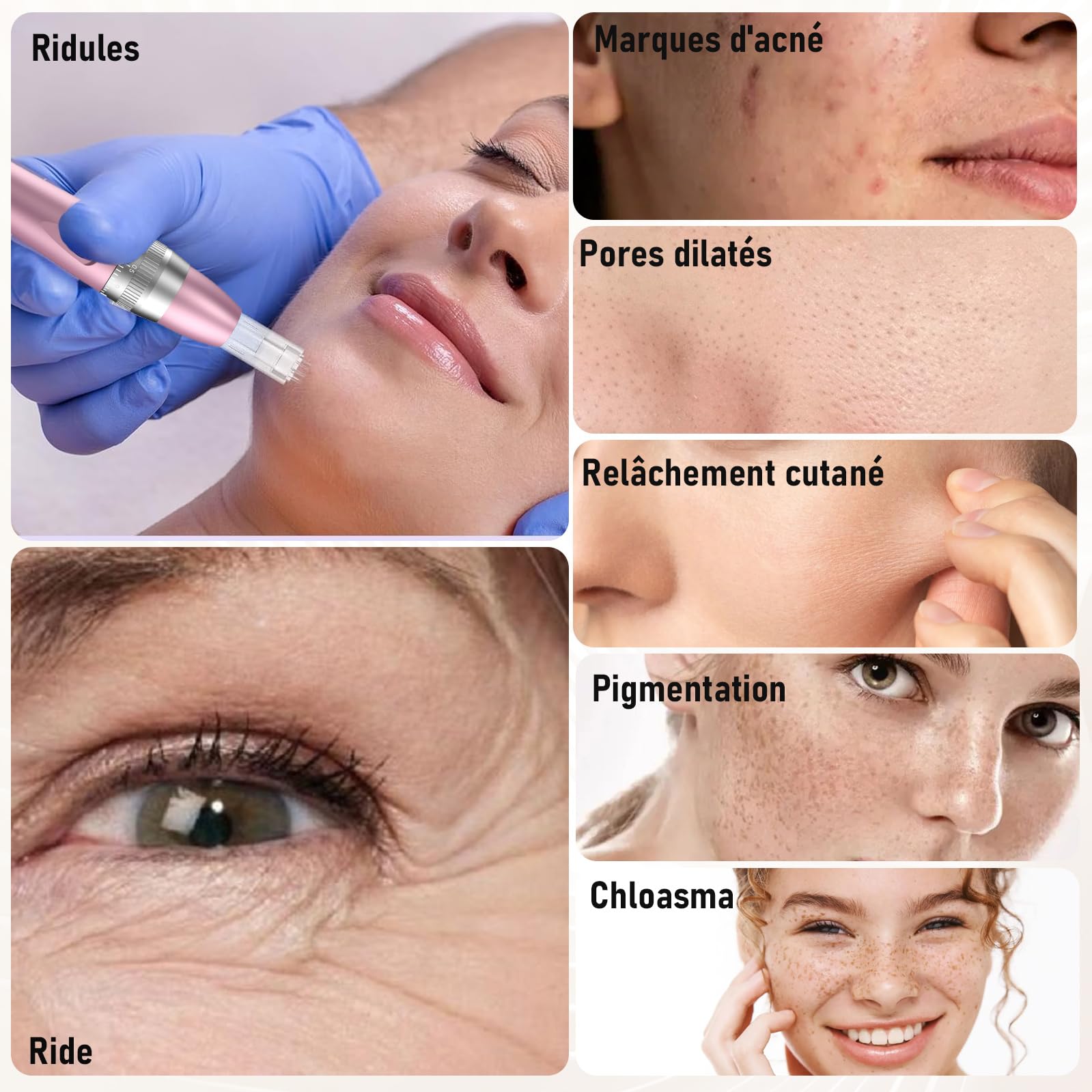 Robofun Stylo Beauté Microneedling avec 7 Lumières, Électrique Microneedling avec 12 Cartouches & 5 Vitesses pour Soin Visage & Corps, Conception Sans Fil et Rechargeable
