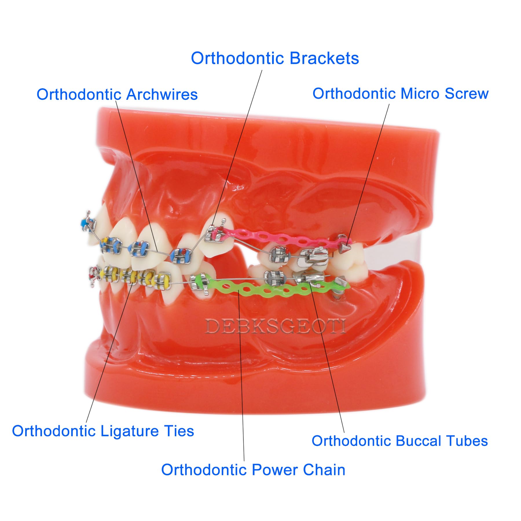 Dental Model, Orthodontic Typodont, Teeth Model Braces, Premolars Deformity, with Arch Wire, Bracket, Single Buccal Tube, Ligature Ties, Teaching Practice Demonstration Tools (M3005-RED)