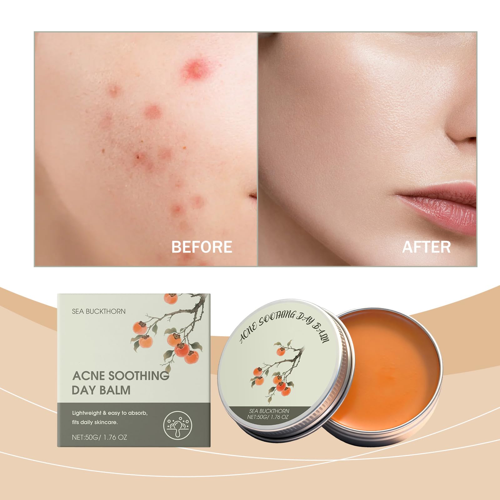 Organics Akne-Wirksamer Tagesbalsam, natürliche pflanzliche Aknebehandlung für Gesicht, Körper und Rücken | Reduziert Pickel, klärende Creme gegen Falten und Feuchtigkeitspflege (12pcs)
