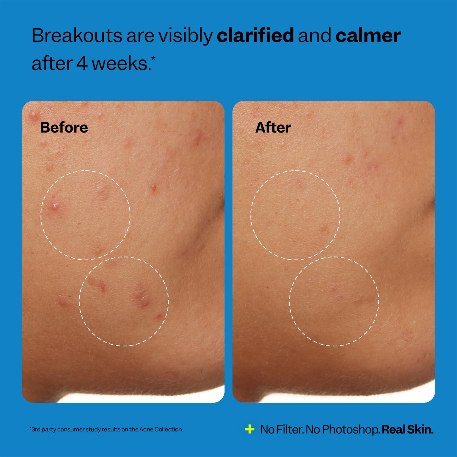 Peach Slices - Acne Clarifying Cleanser (4.05 oz) - 2% Salicylic Acid Acne Treatment - Clear & Prevent Breakouts, Hydrate - Cucumber, Cica, Acerola - Vegan, Cruelty Free, Korean Skin Care & Beauty - Image 7