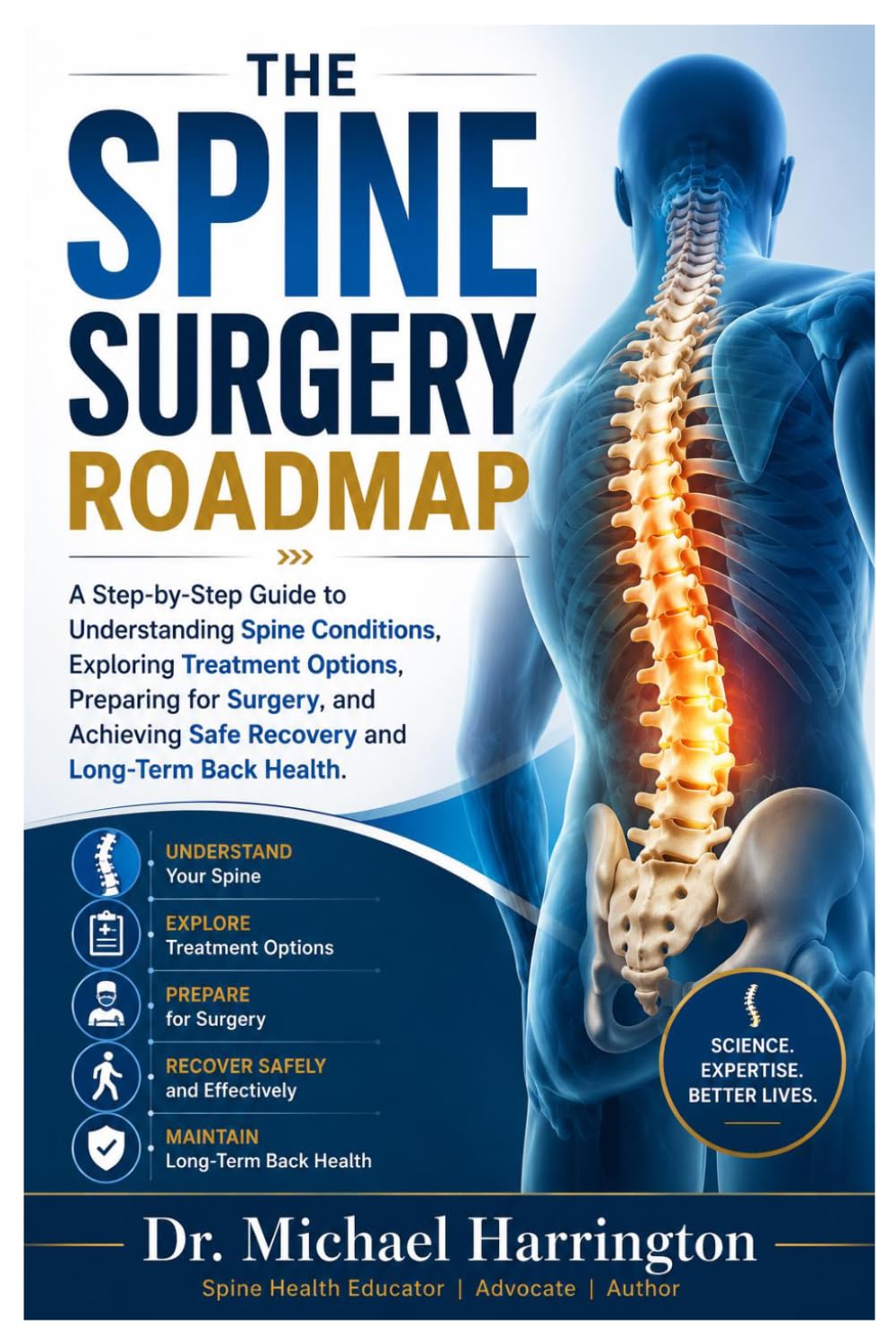 THE SPINE SURGERY ROADMAP: A Step-by-Step Guide to Understanding Spine Conditions, Exploring Treatment Options, Preparing for Surgery, and Achieving Safe Recovery and Long-Term Back Health