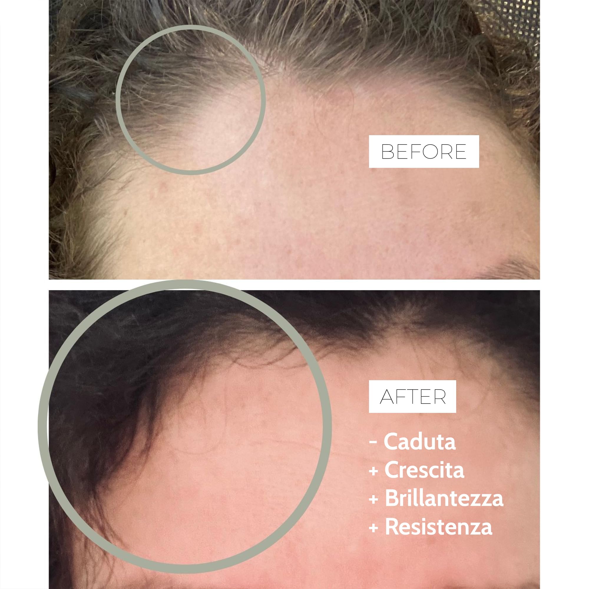 Stop & Grow Hair – Integratore Alimentare - 60 Capsule | Aiuta contro la Caduta dei Capelli, Stimola la Crescita - Uomo e Donna - KeranatTM, Biotina, Ferro, Estratto di Carciofo