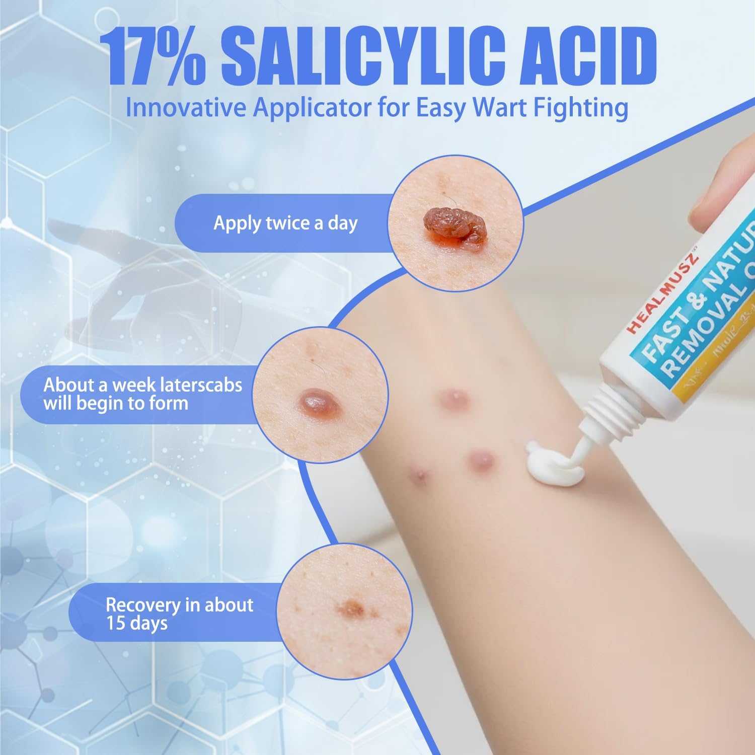 HEALMUSZ Wart Remover Cream,17% Salicylic Acid Fast-Acting to Remove HPV Warts and Common, Flat, Plantar Warts.(NDC:84010-092-01) - Image 4