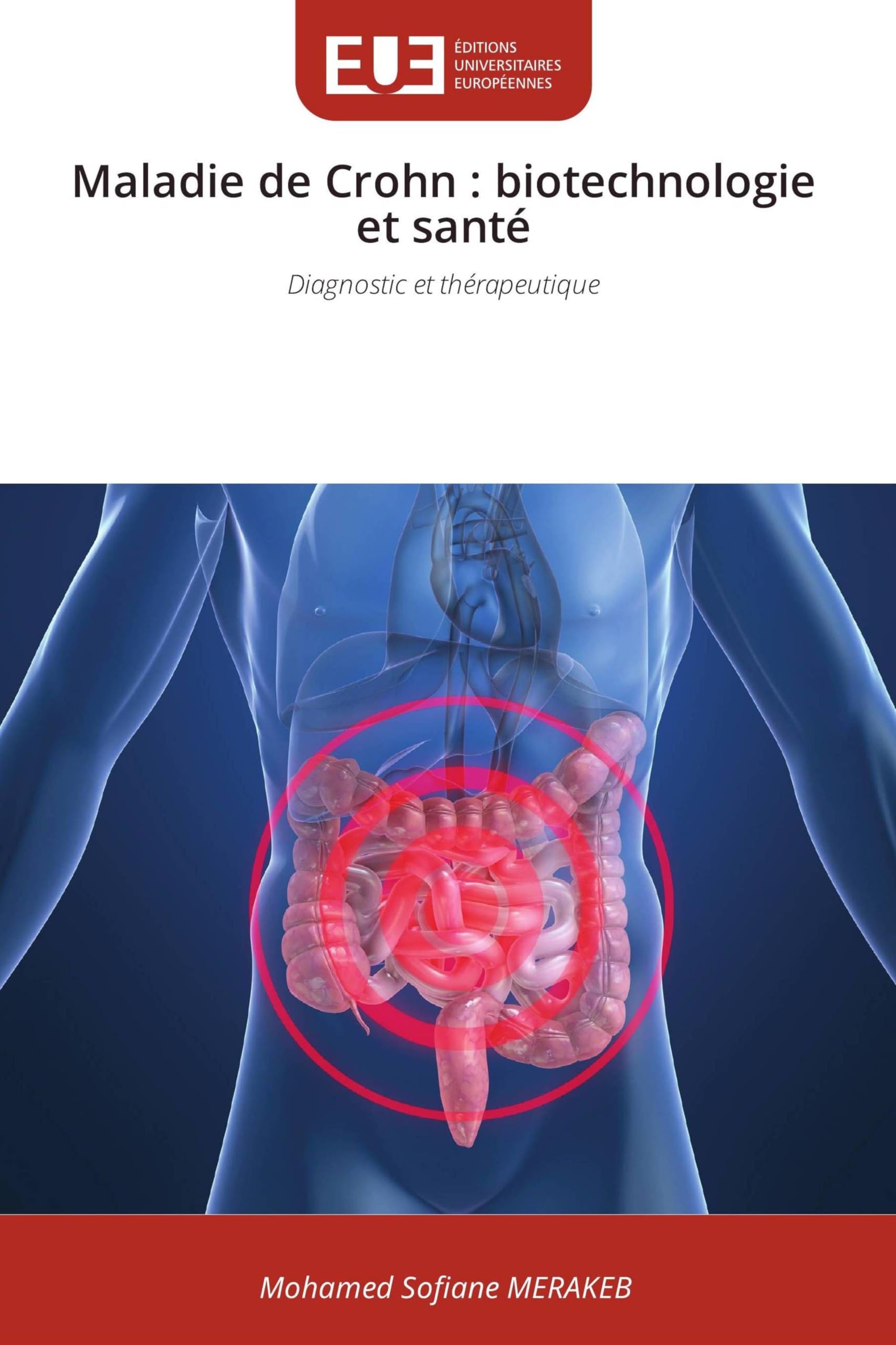 Maladie de Crohn: biotechnologie et santé