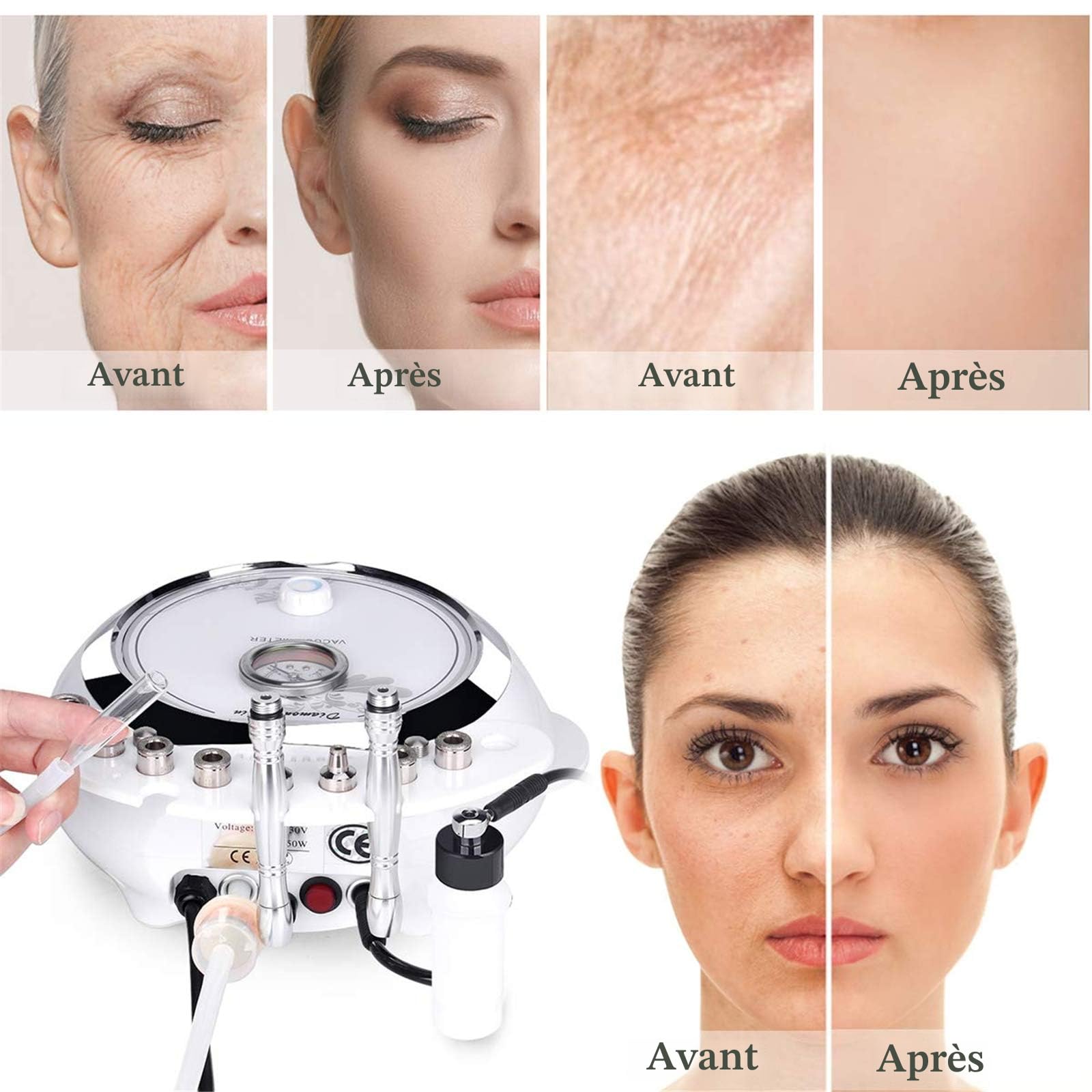[Version de mise à niveau] 3 en 1 TwoWin Machine de Microdermabrasion Diamant Appareil de Dermabrasion pour soins du visage Pour usage Personnel Domestique Puissance d'aspiration 65-68 cmHg