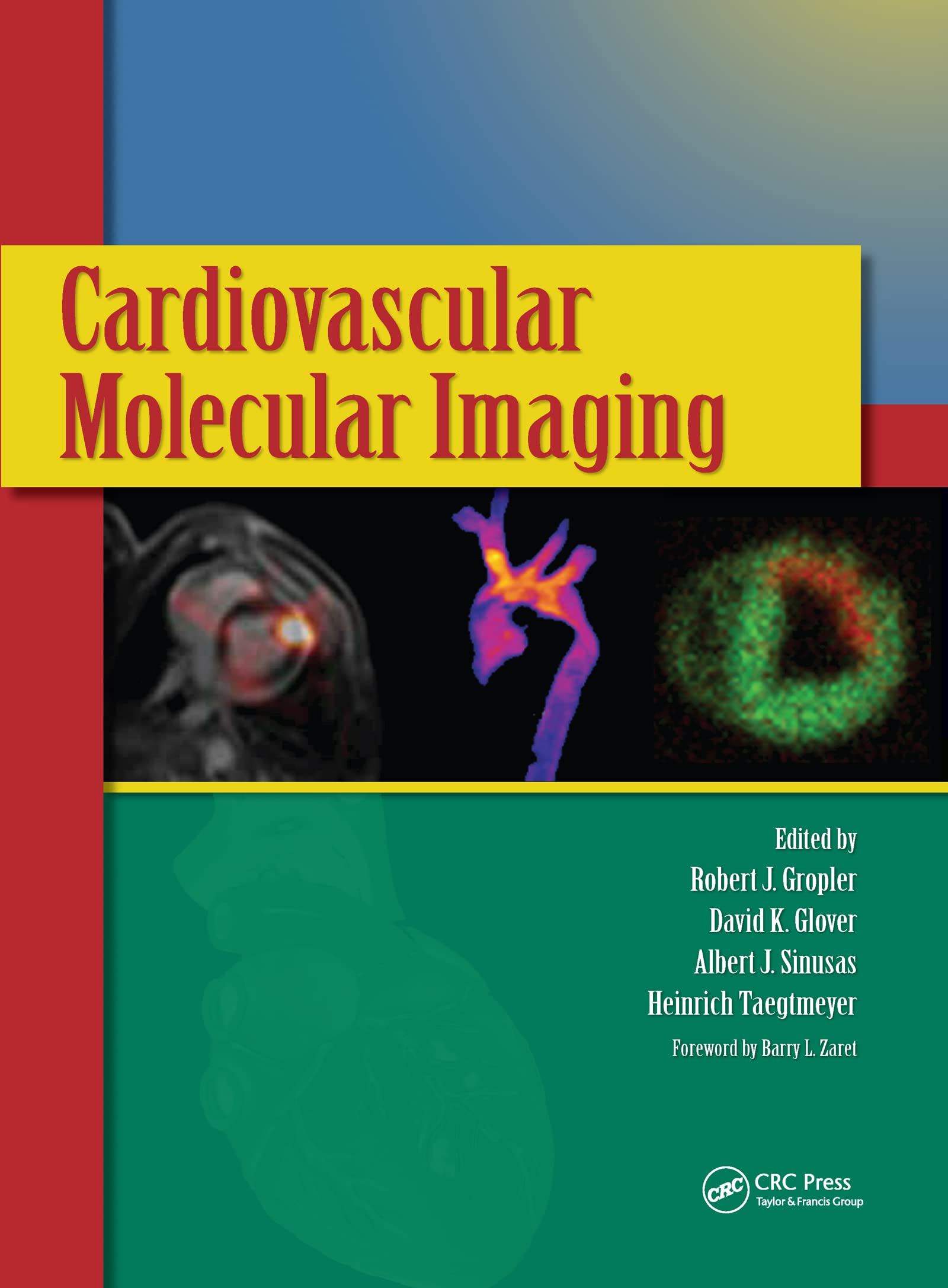 Cardiovascular Molecular Imaging