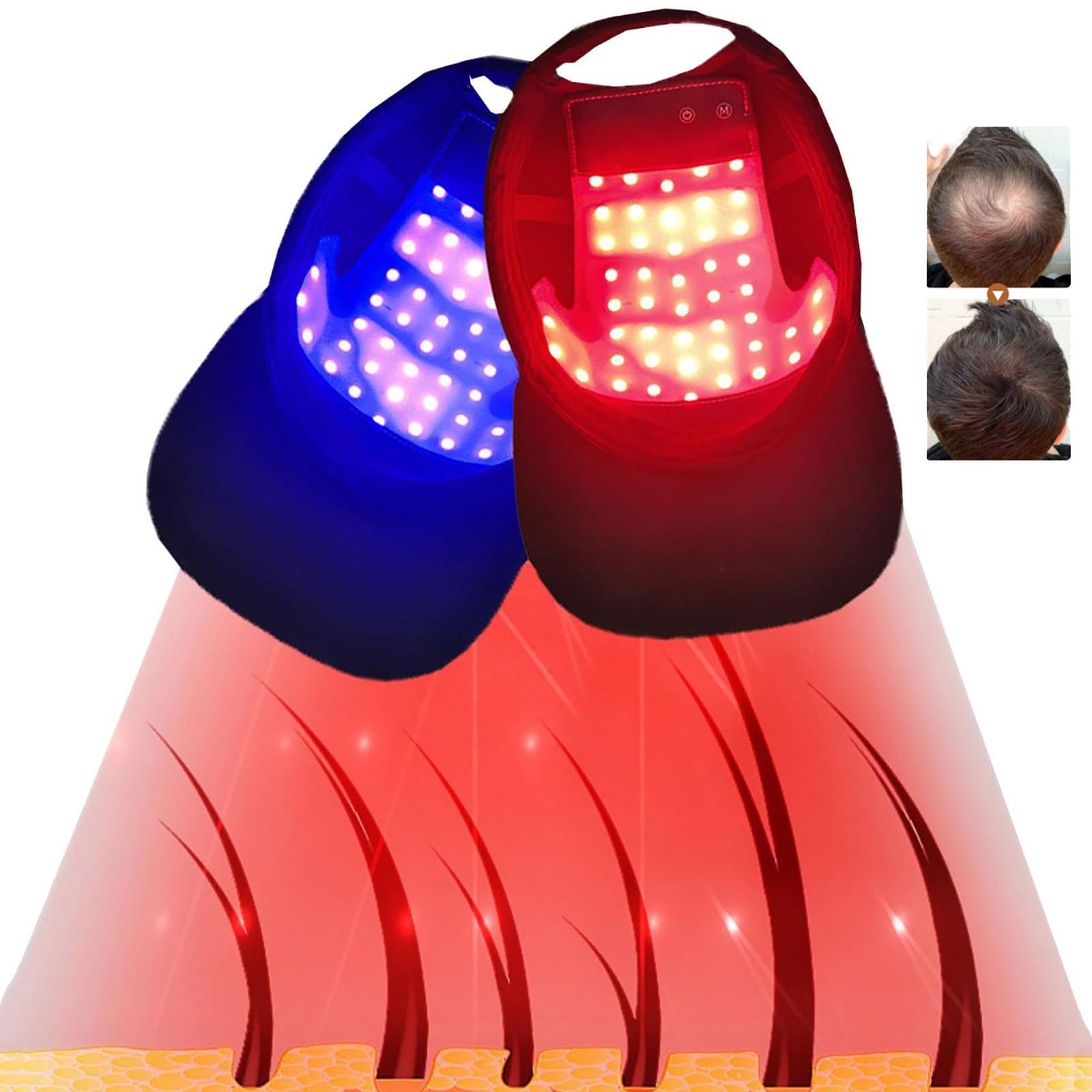 Cuffia Per Terapia Con Luce Rossa Per La Ricrescita Dei Capelli (48 Led), 630Nm 650Nm 470Nm Luce Rossa E Blu, 4 Modalità, Per La Perdita Dei Capelli Promuove La Rapida Ricrescita Dei Capelli Cuffia