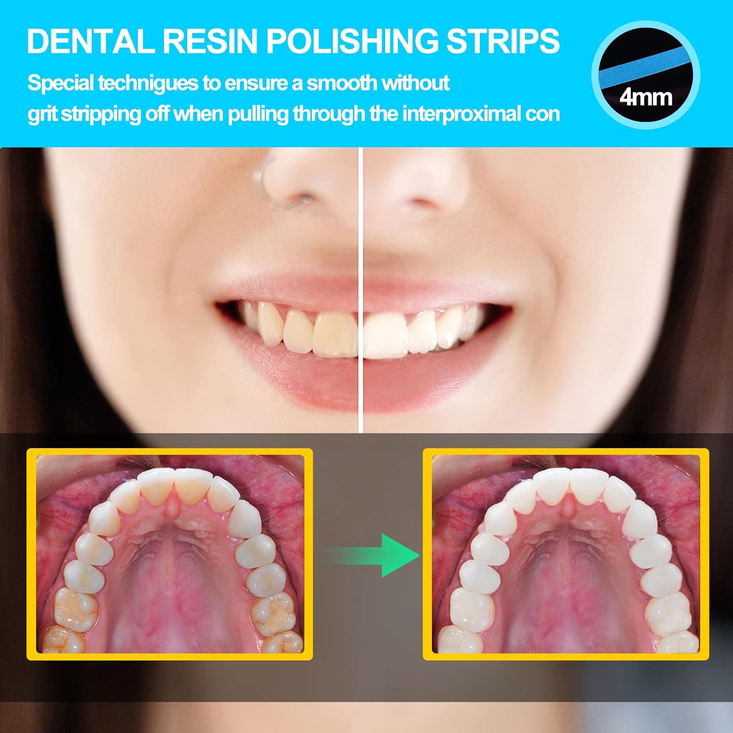 AISEELY Dental Polishing Strips, 1Pc Whitening Strip, 4mm Tooth Sandpaper Thickness Teeth Resin