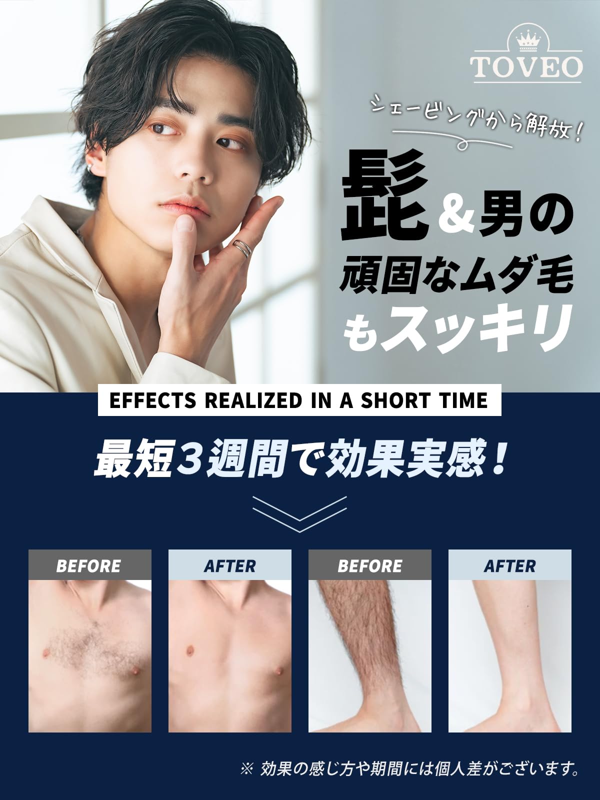 Toveo 脱毛器 フラッシュ式 IPL技術　家庭用脱毛器 Toveo 脱毛器 フラッシュ式 IPL技術家庭用脱毛器