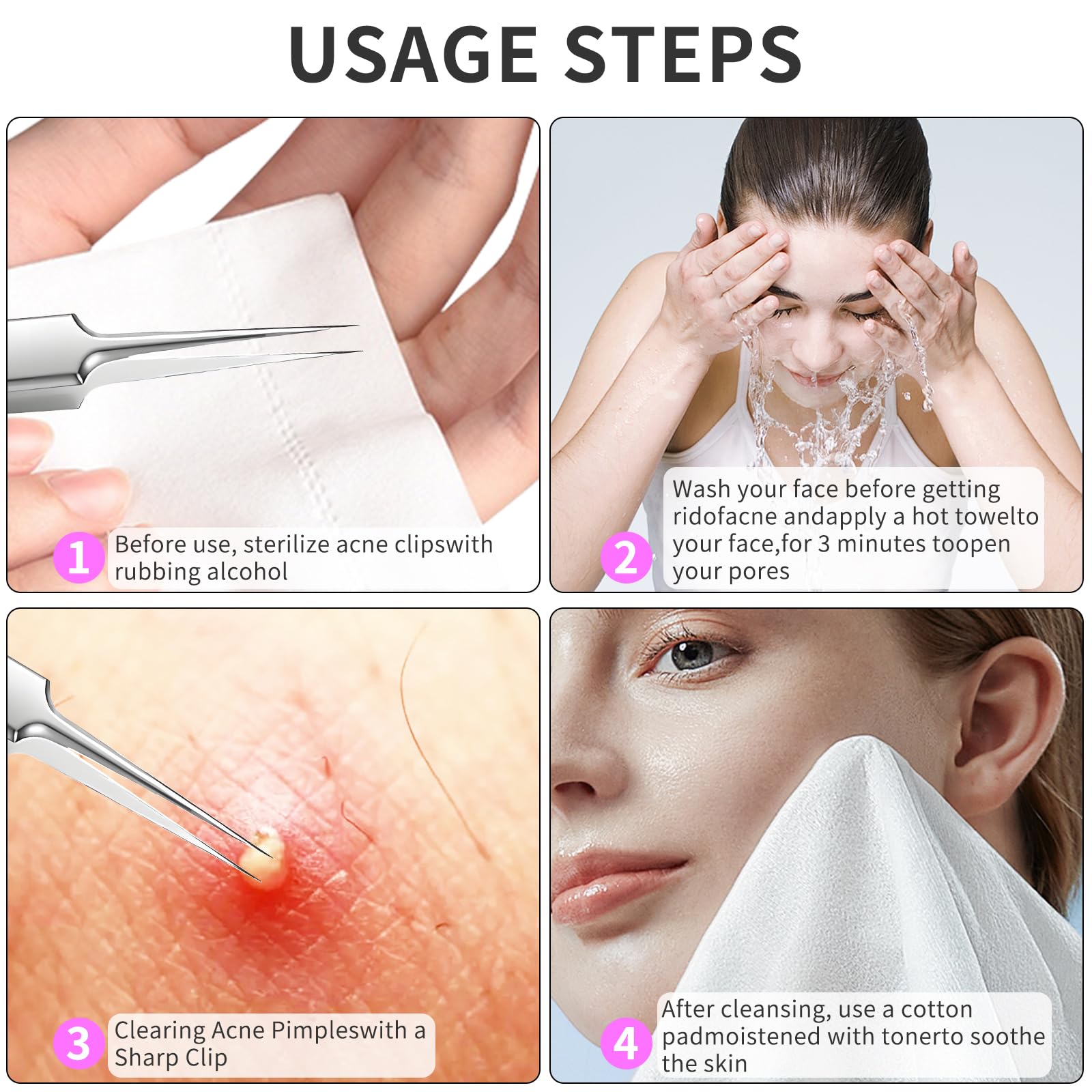 3 Piezas Pinzas de Punta Fina, Eliminación de Pinzas Blackhead Precisión Acero Inoxidable Depilar Punta Fina Profesionales para Espinillas Acné Cejas Pelo Encarnado (con Caja)