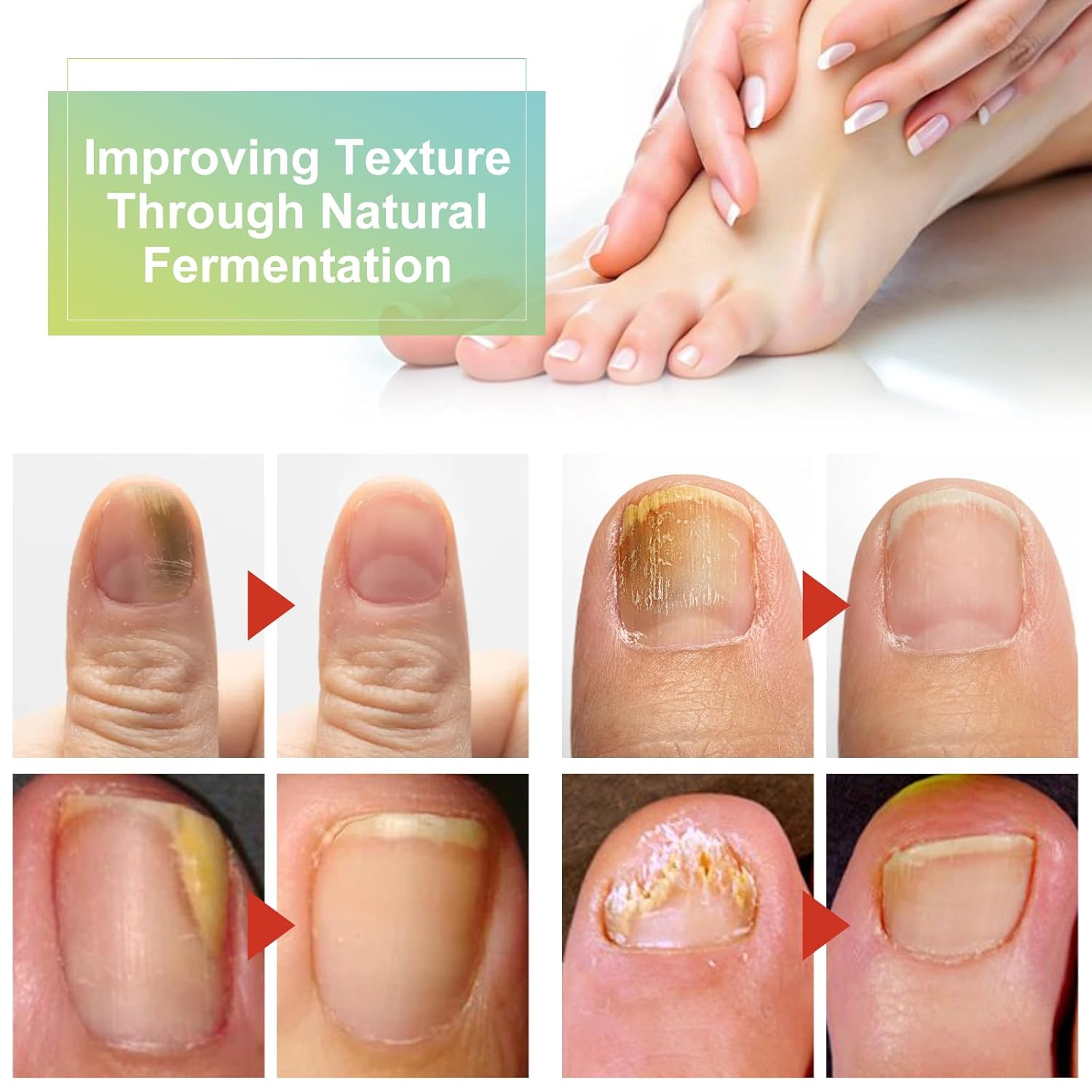 Nail Care Cream,Phrena Toenail Nail Repair for Damaged,Natural Formula with Tea Tree Oil, Oregano Oil,Vitamin E & Allantoin,60ml/2.03fl.oz