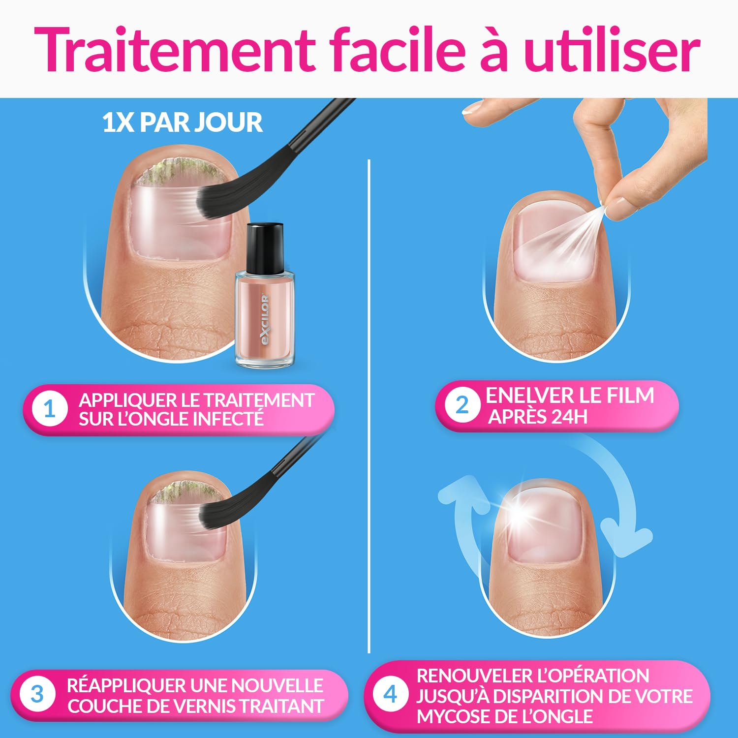 EXCILOR - Forte Color - Trattamento della micosi dell'unghia - Tratta e copre - Trattamento 30 ml + Smalto cosmetico per unghie da 8 ml - Clinicamente provato* - Nude