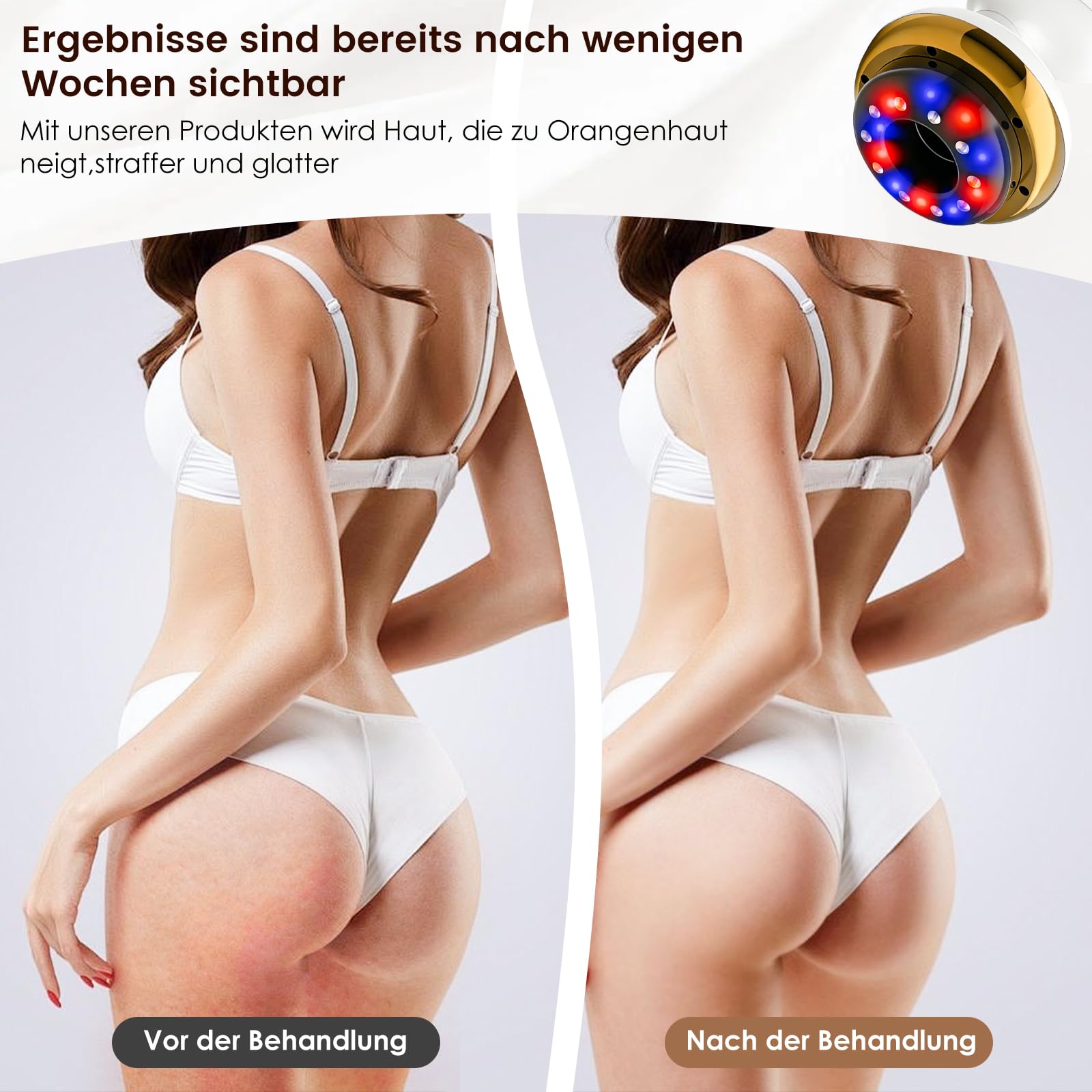 Vacuvia Cellulite Massager, 4-in-1 Vakuum Massagegerät gegen Cellulite mit Wärmetherapie & LED-Licht, Elektrisches Schröpfgerät für Lymphdrainage, Anti-Cellulite Massagegerät (Premiummodell)