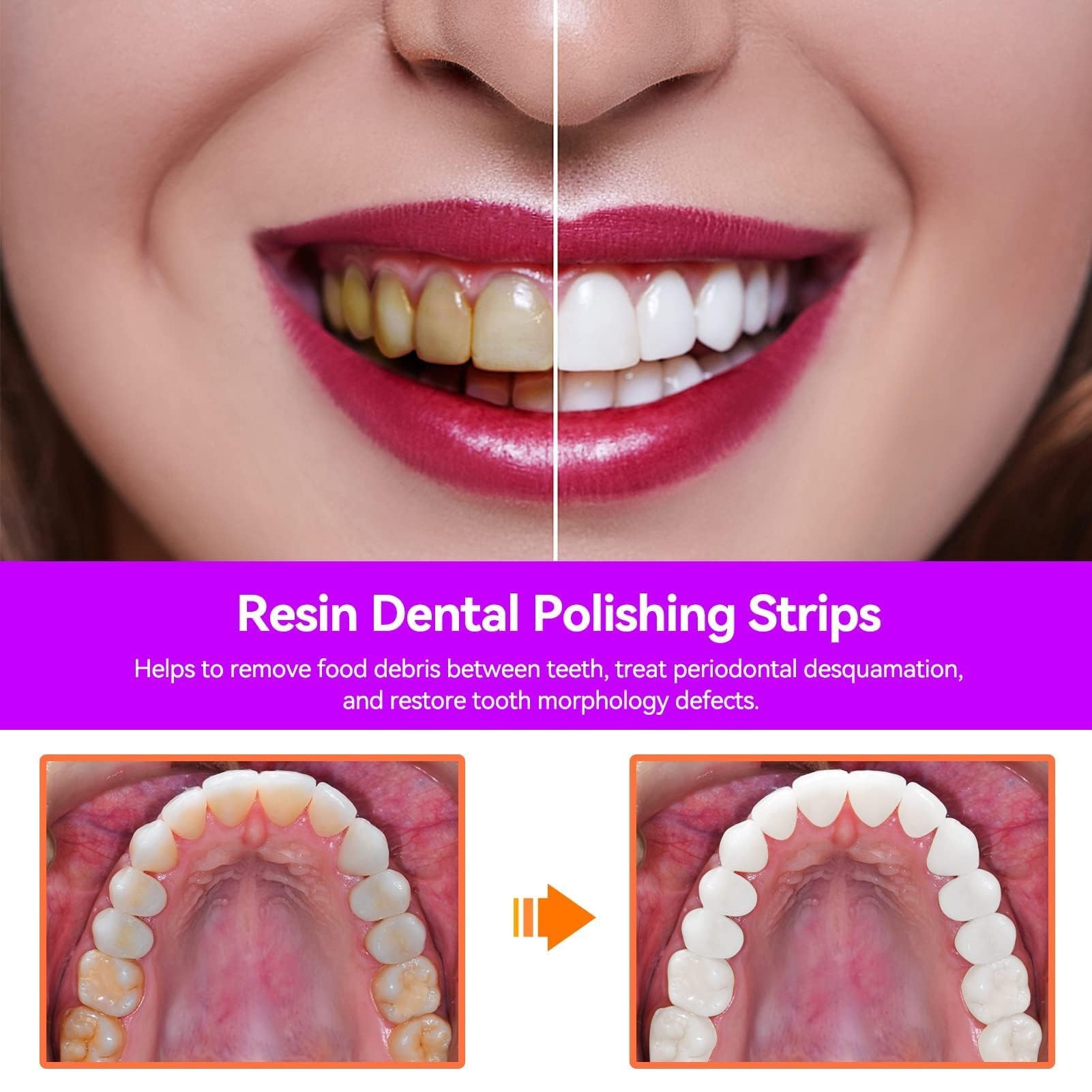 Tiras Dentales Pulidoras Doble Cara 50um Papel De Lija Dental Herramienta De Cuidado Oral