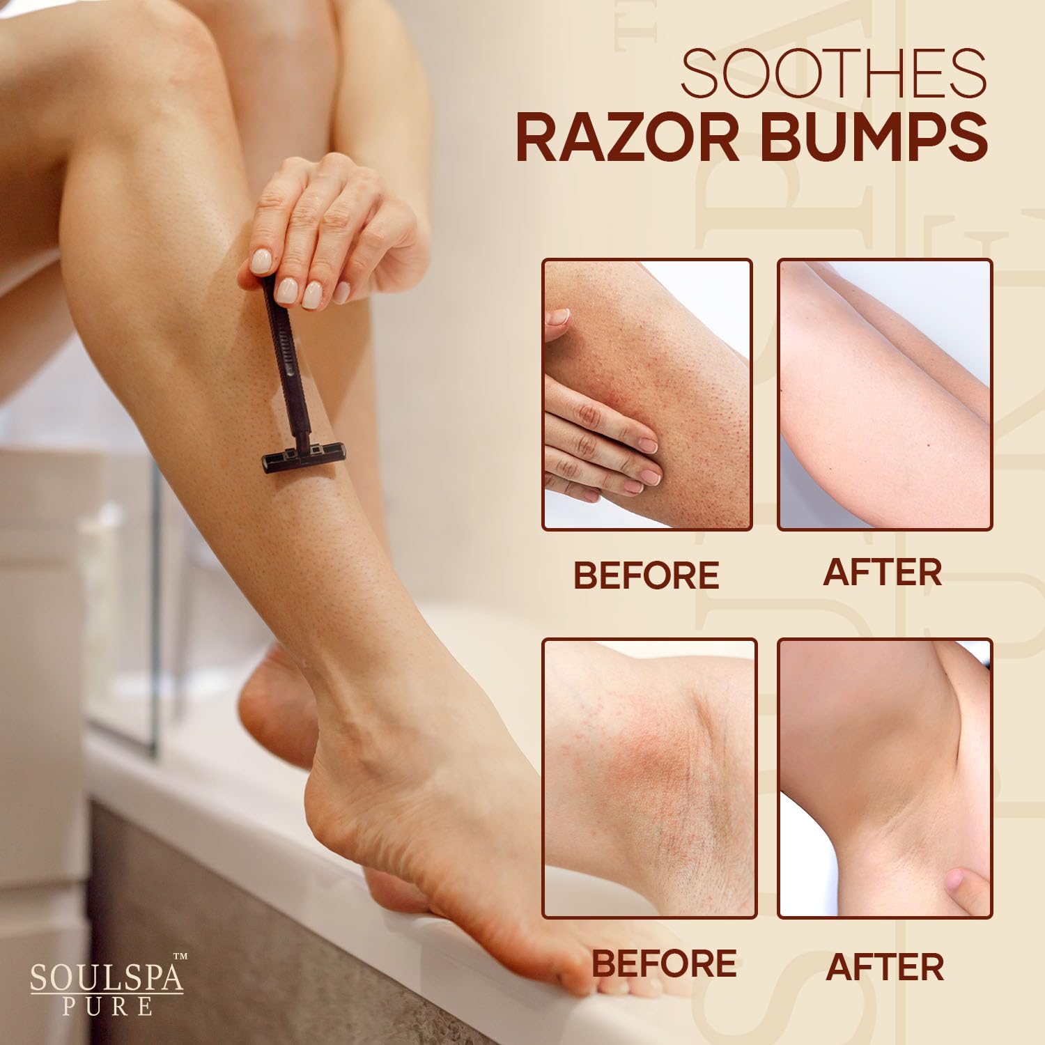 Ingrown Hair Serum - Powerful Razor Bump Solution for Bikini Area, Face & Brazilian Wax - Ingrown Hair Oil that Soothes, Exfoliates & Nourishes - 2 fl oz - Image 3