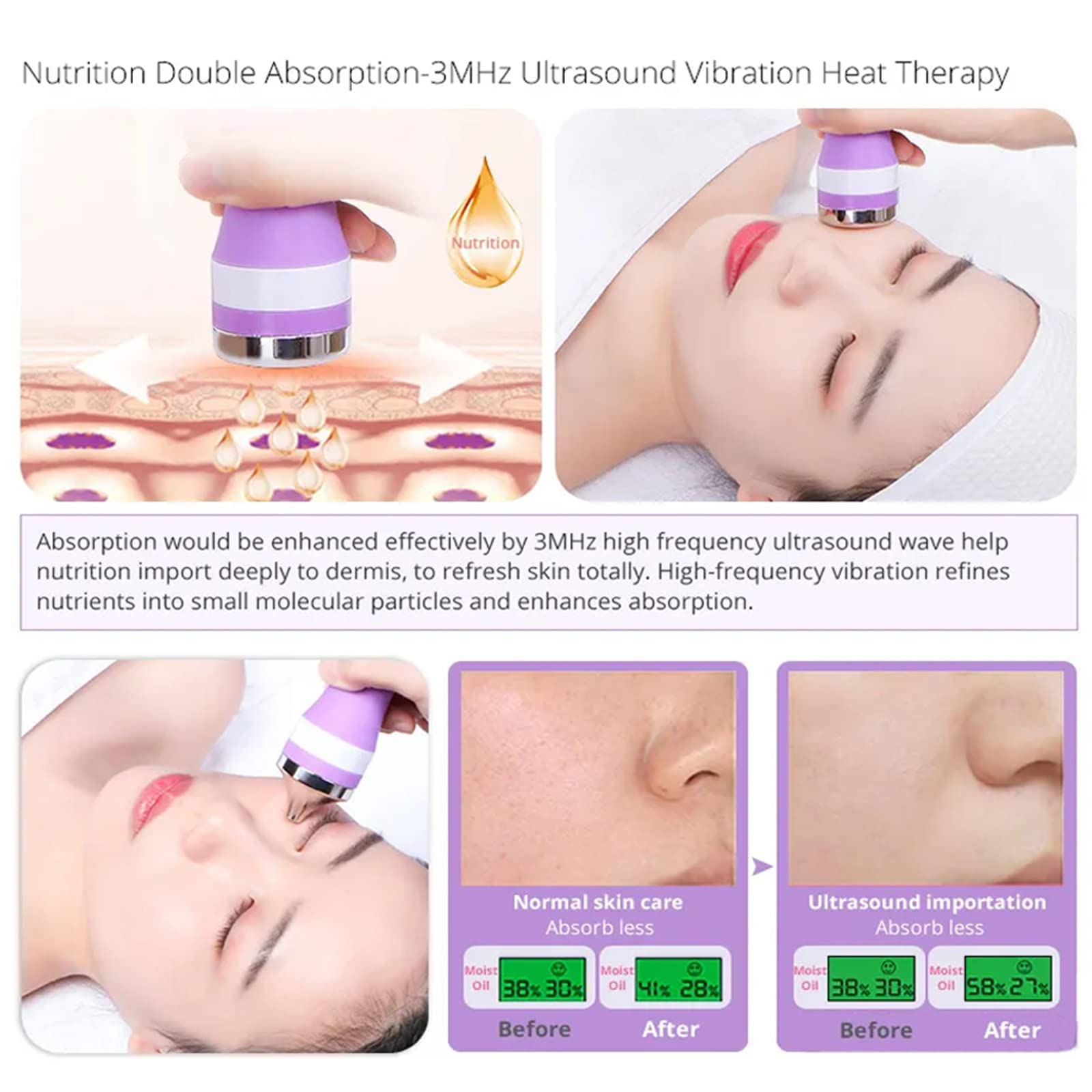 Máquina facial galvánica profesional 5 en 1: dispositivo de belleza de microdermoabrasión e iontoforesis para limpieza profunda, infusión de suero y estiramiento de la piel, sistema de spa facial en