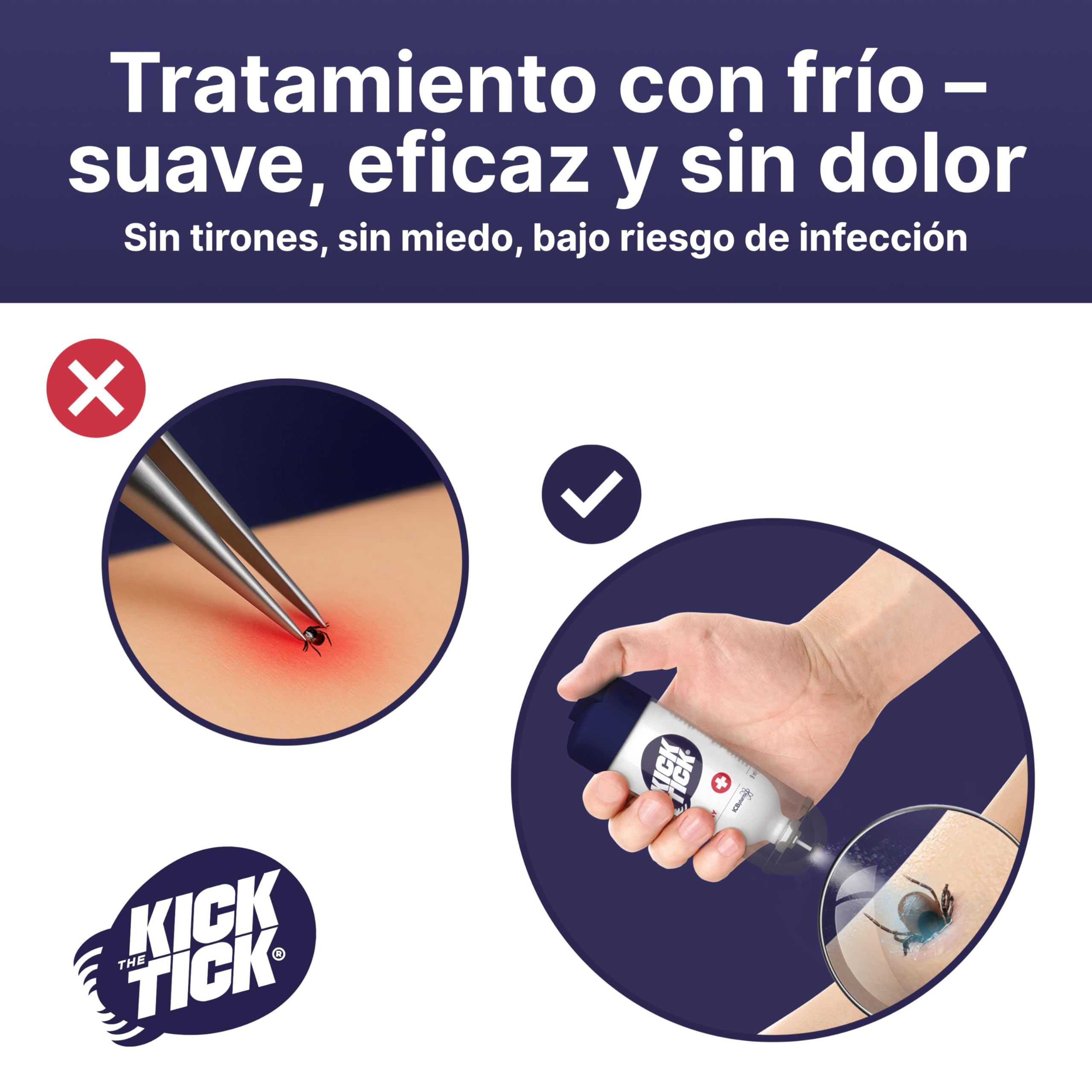 Novokill Kick The Tick Set 2X | Removedor con Spray Helado y Pinzas Profesionales | Elimina Garrapatas de Forma Fácil y Segura | 2X 9ml para Perros y Humanos